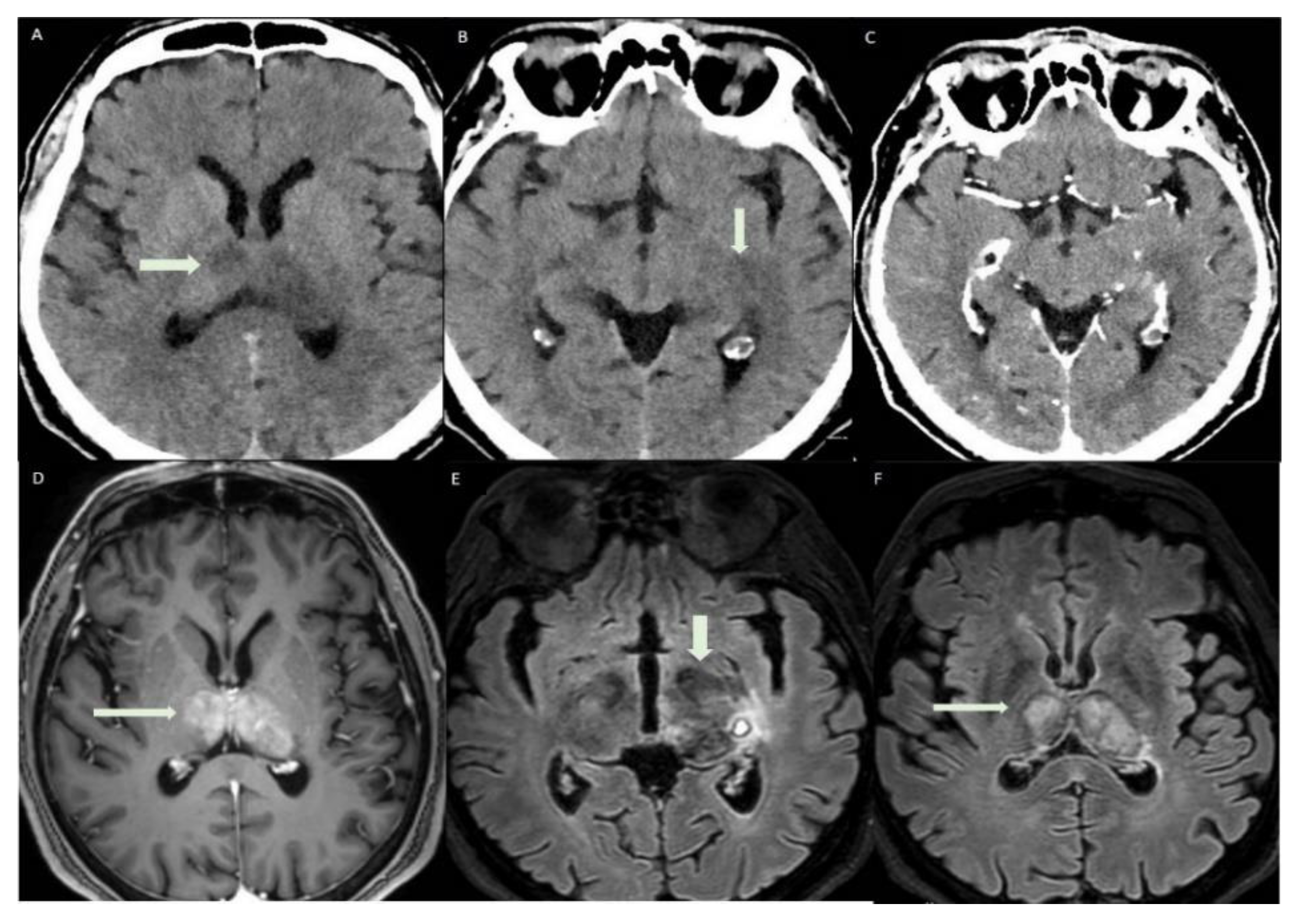 Diagnostics 12 01253 g005 550