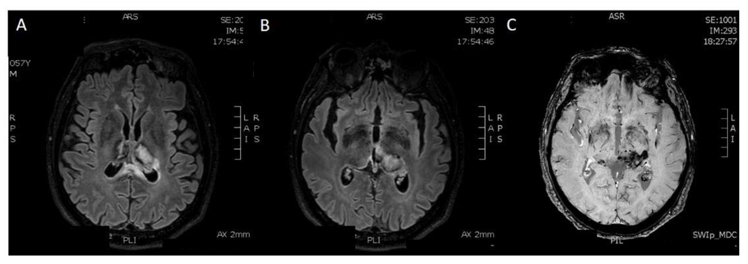 Diagnostics 12 01253 g006 550