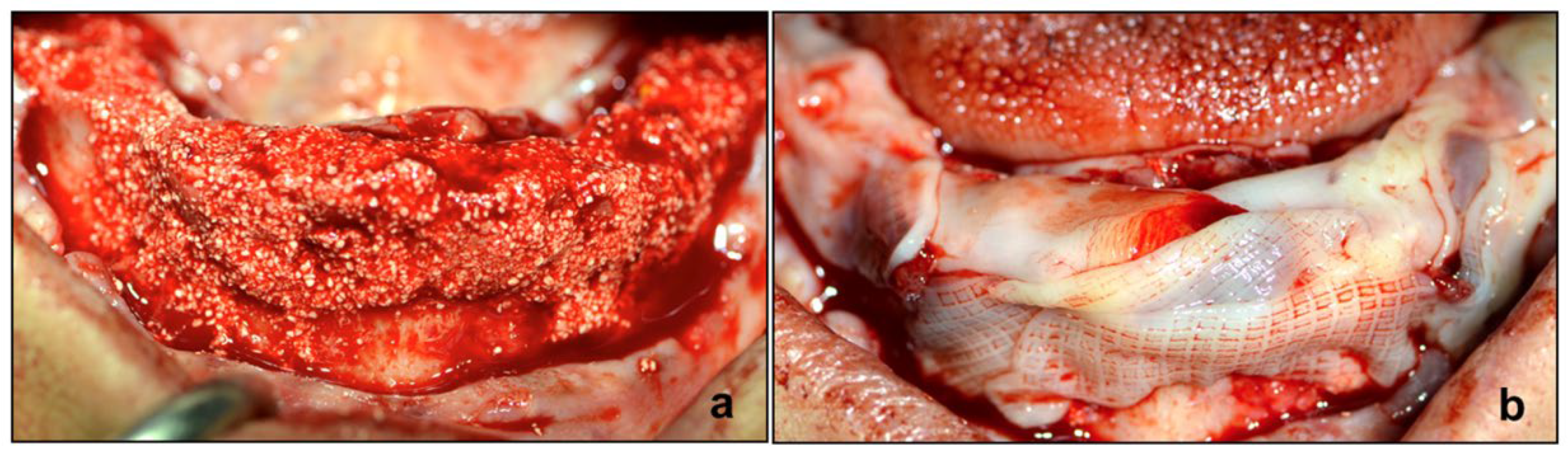 Diagnostics 12 01257 g005 550