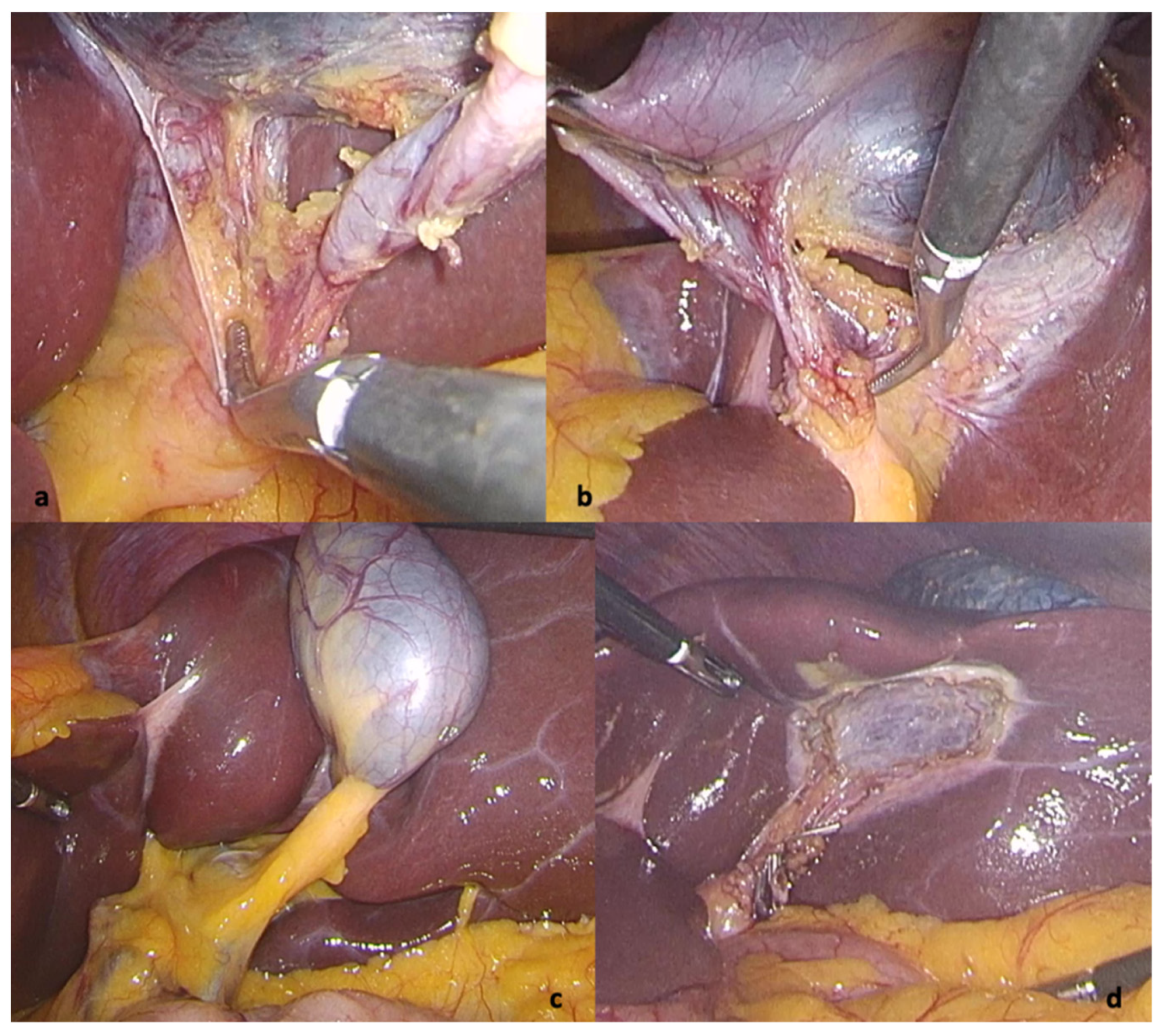 Diagnostics 12 01265 g003