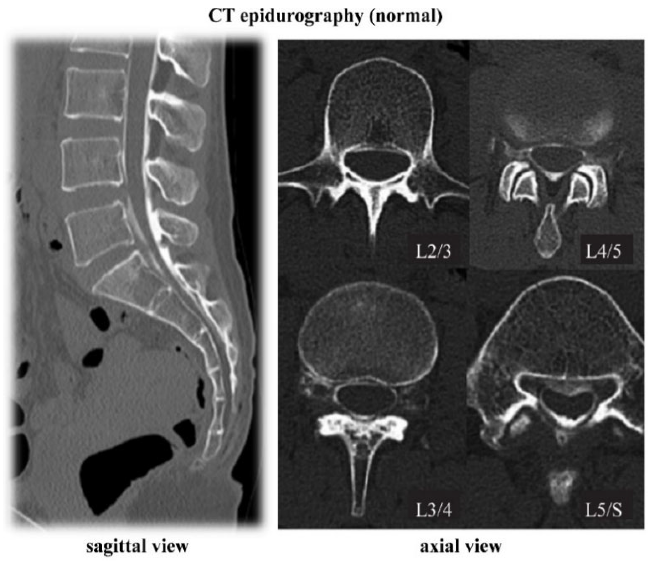 Diagnostics 12 01267 g002 Diagnostics 12 01267 g002