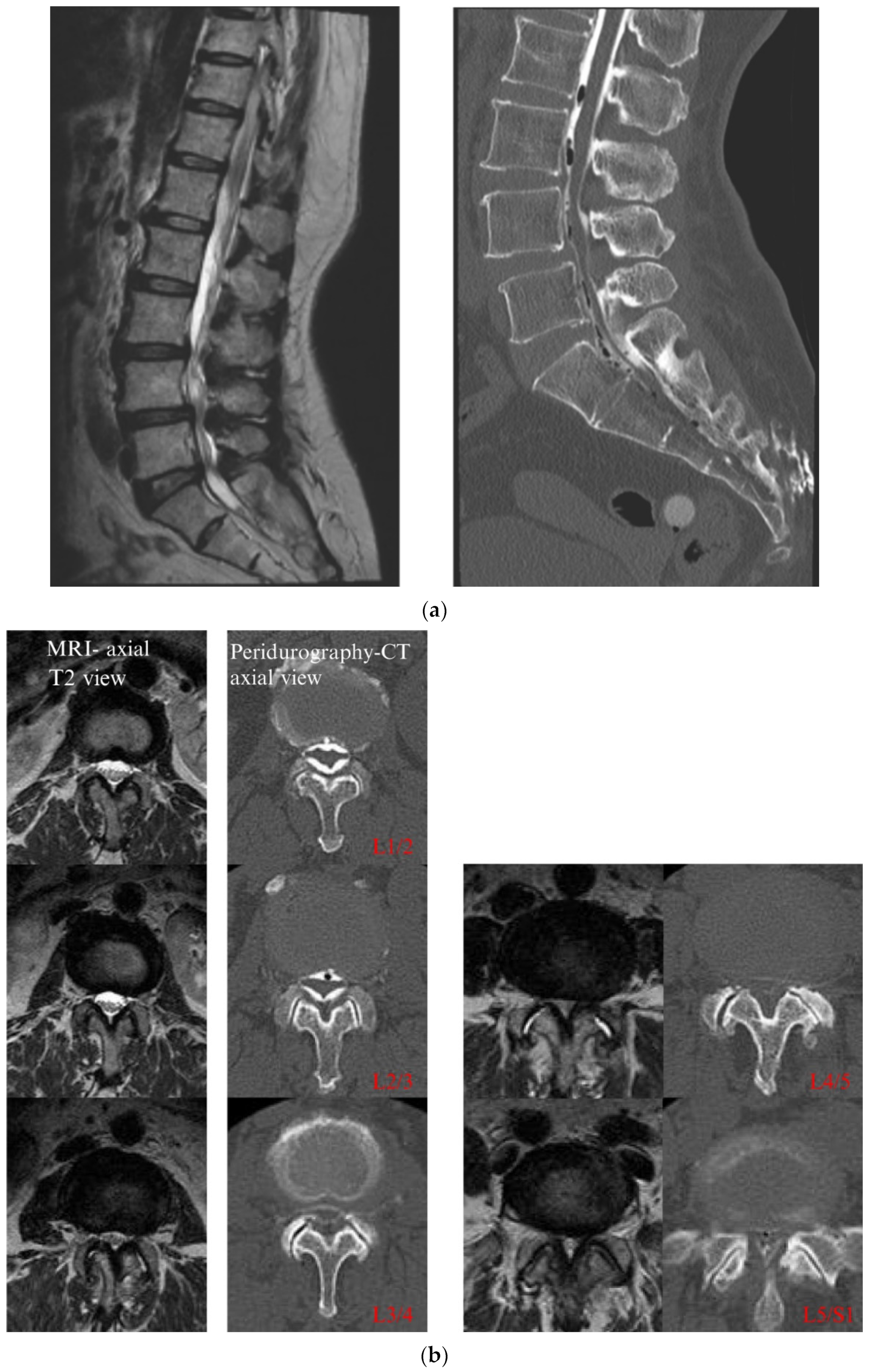 Diagnostics 12 01267 g003 Diagnostics 12 01267 g003