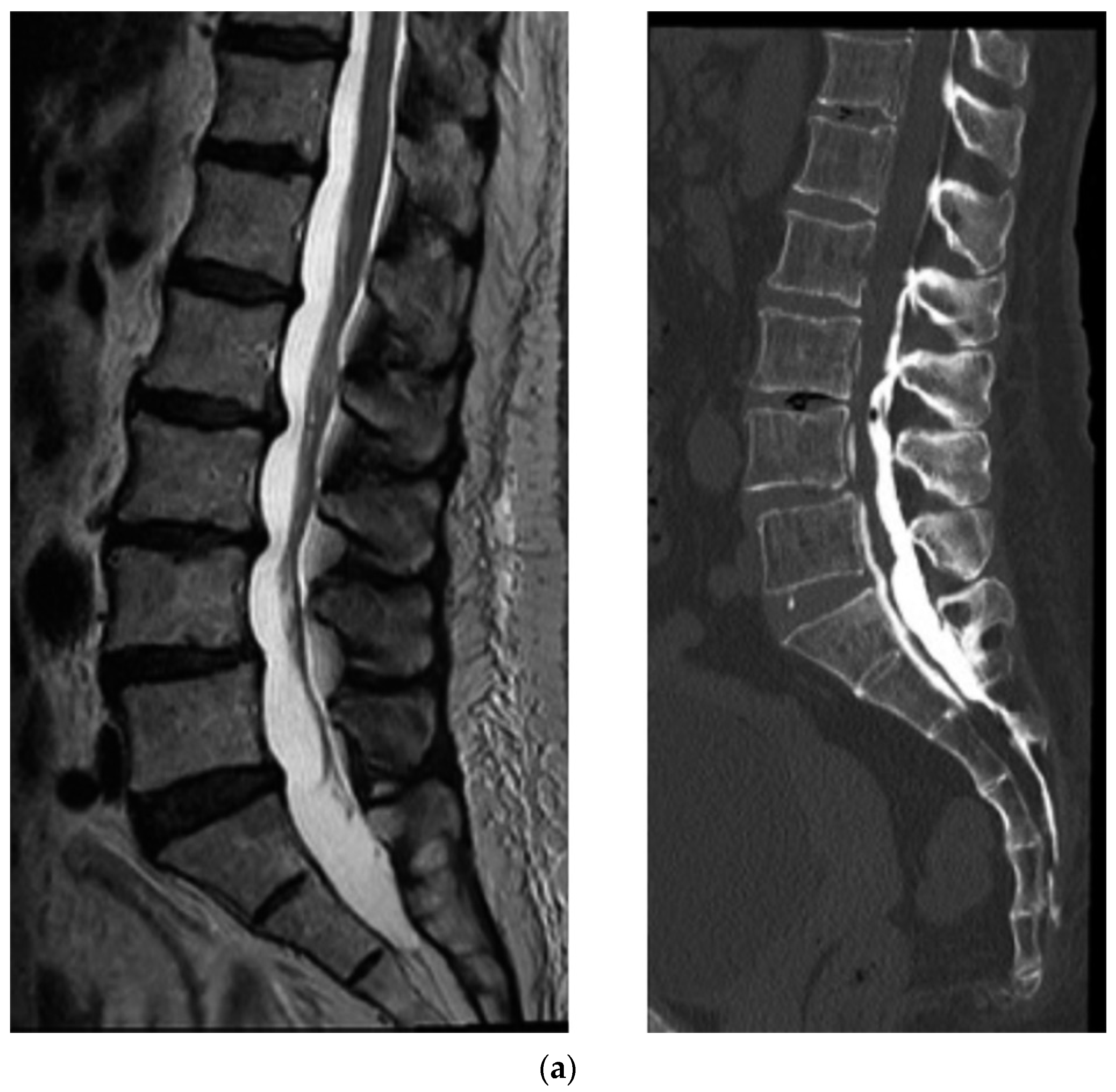 Diagnostics 12 01267 g005a Diagnostics 12 01267 g005a