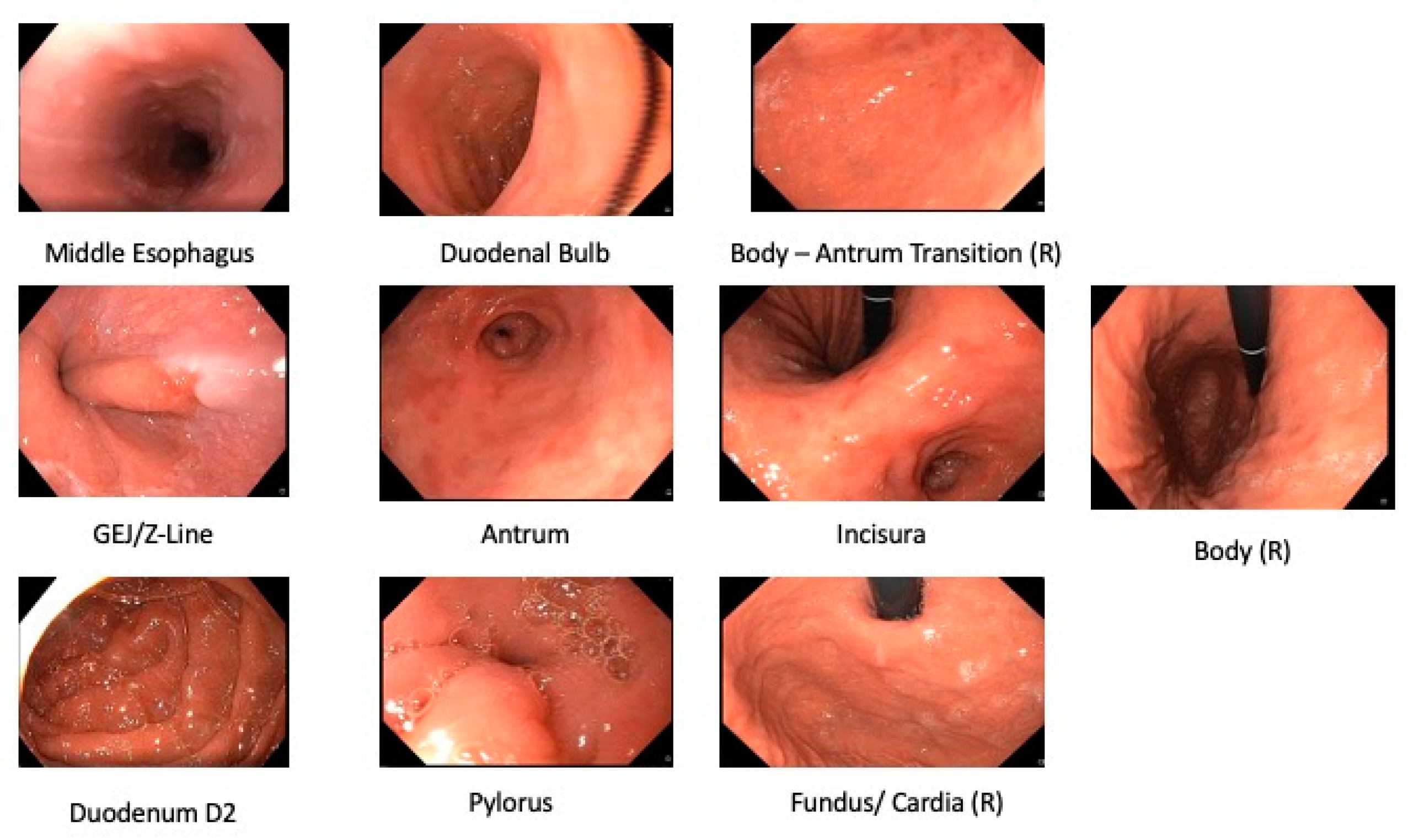 Diagnostics | Free Full-Text | Artificial Intelligence for Upper  Gastrointestinal Endoscopy: A Roadmap from Technology Development to  Clinical Practice