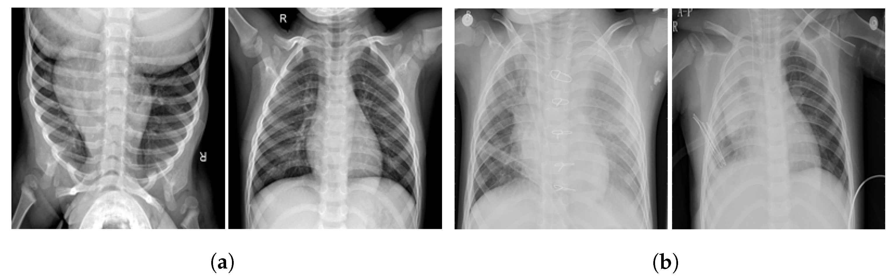 Diagnostics 12 01280 g002 550