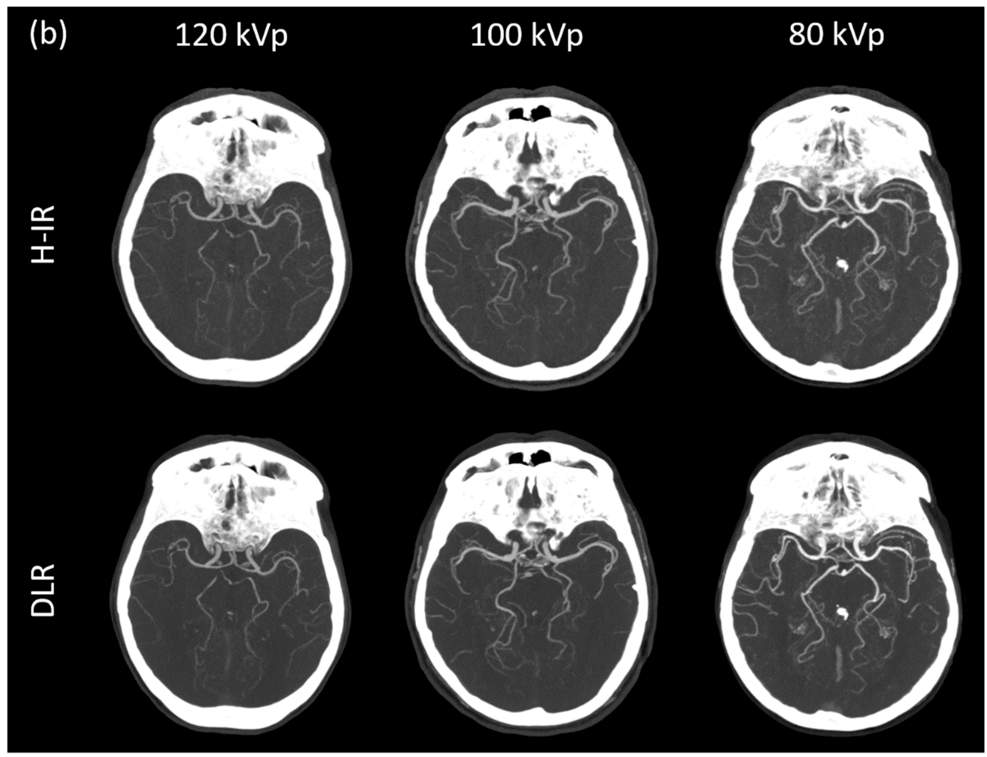 Diagnostics 12 01287 g003b