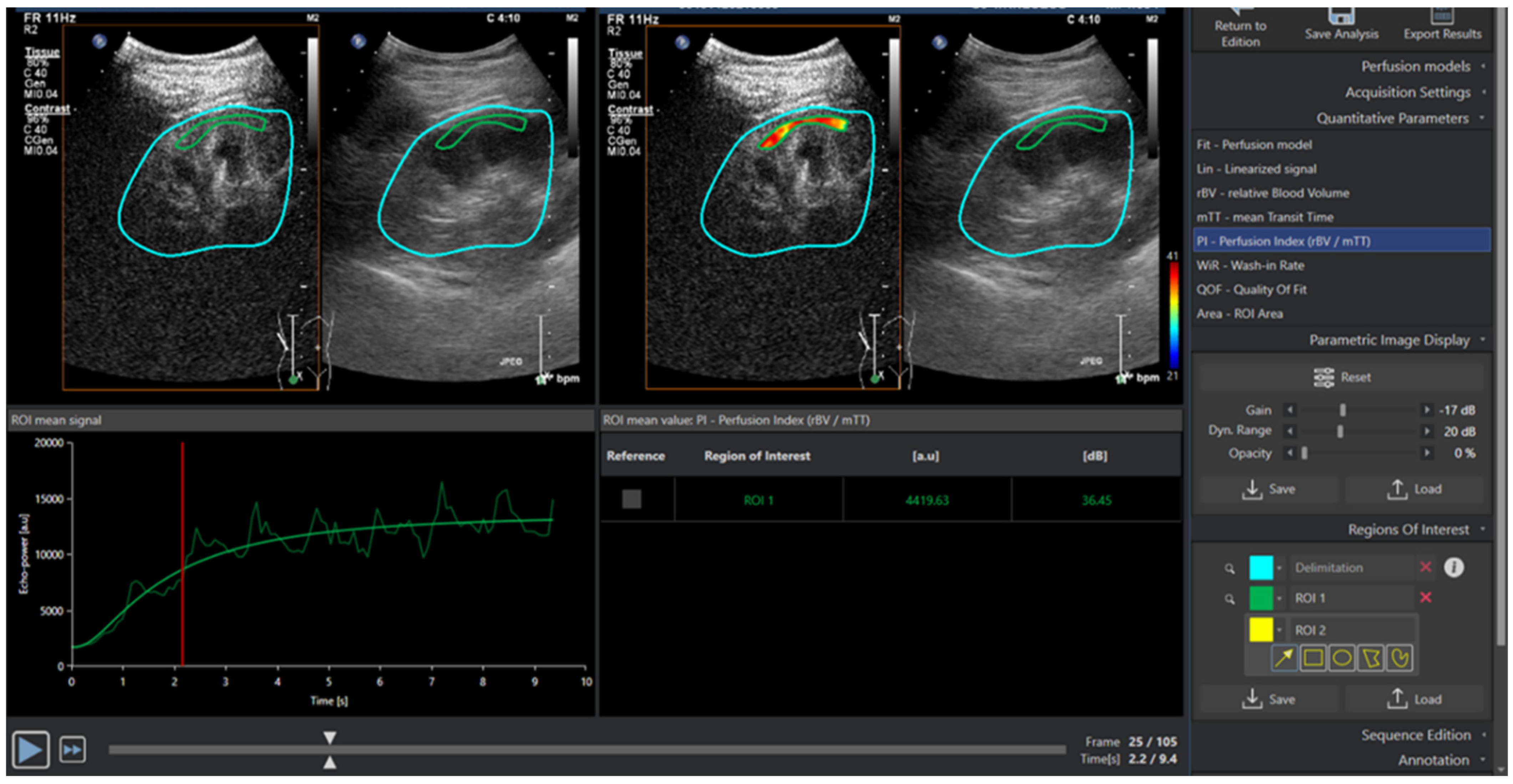 Diagnostics 12 01293 g001 550