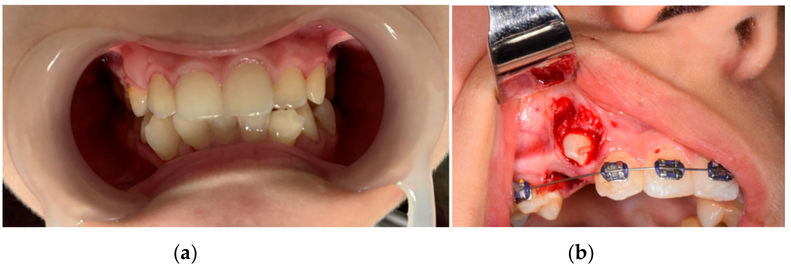 Diagnostics 12 01296 g002