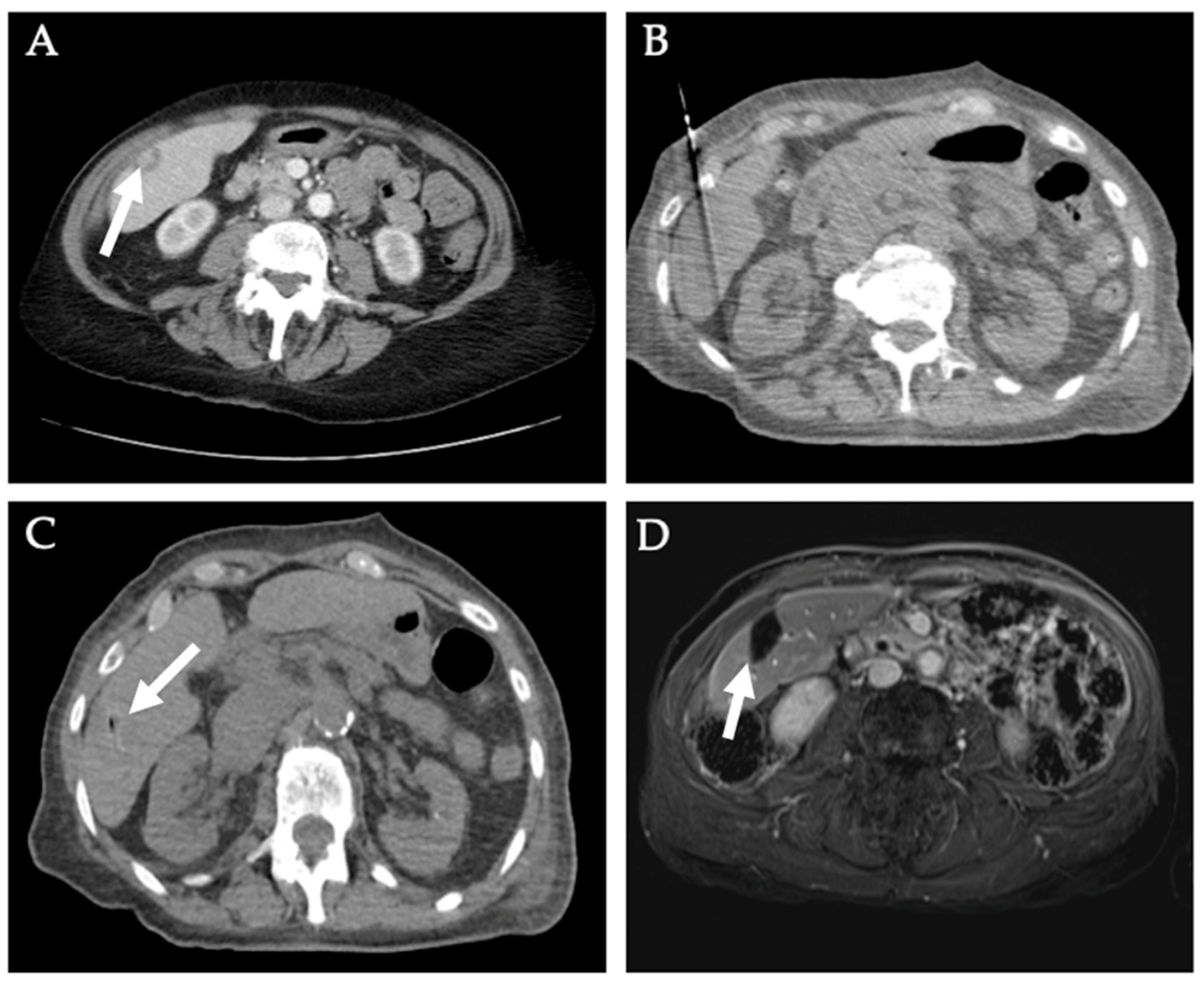 Diagnostics 12 01300 g008 550