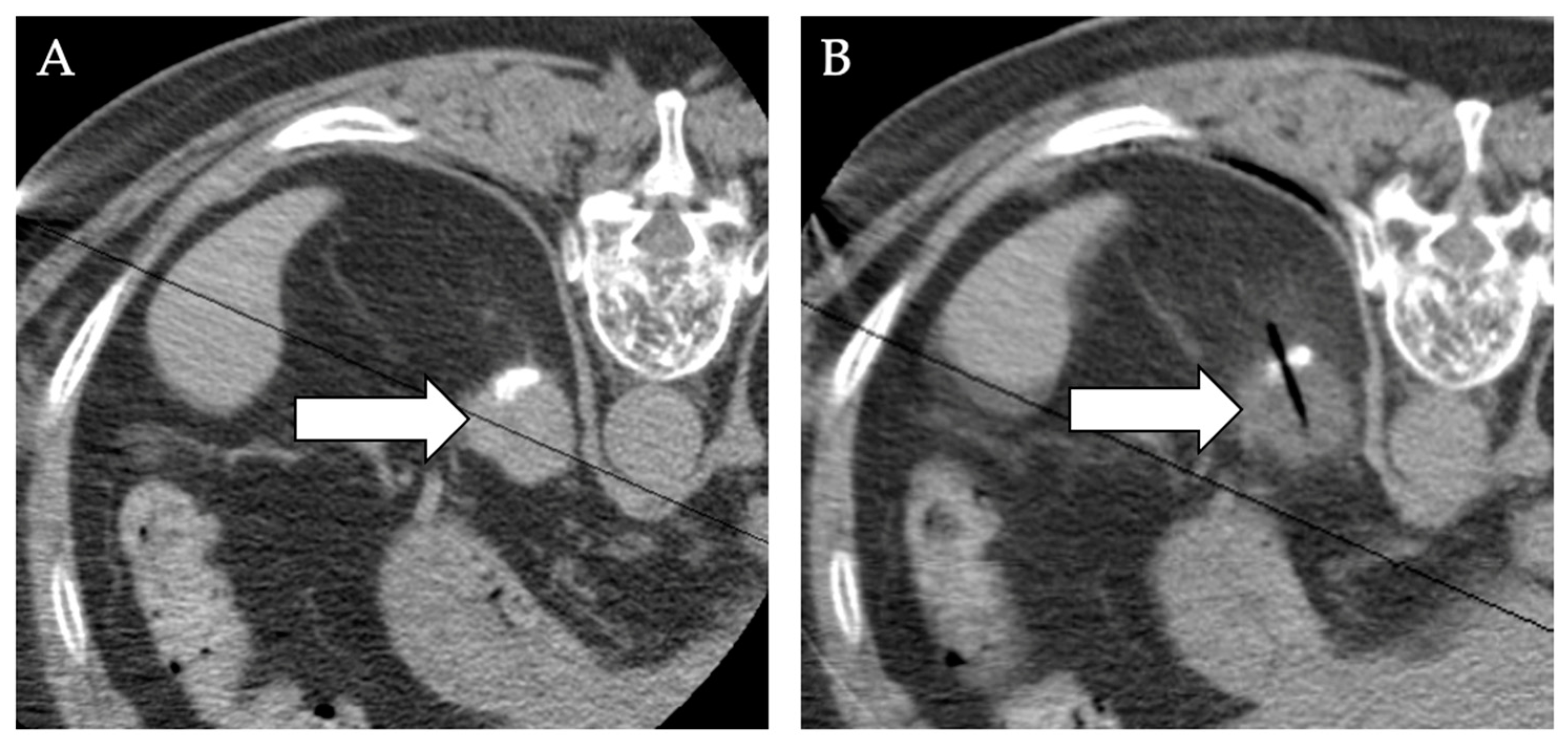 Diagnostics 12 01300 g012 550