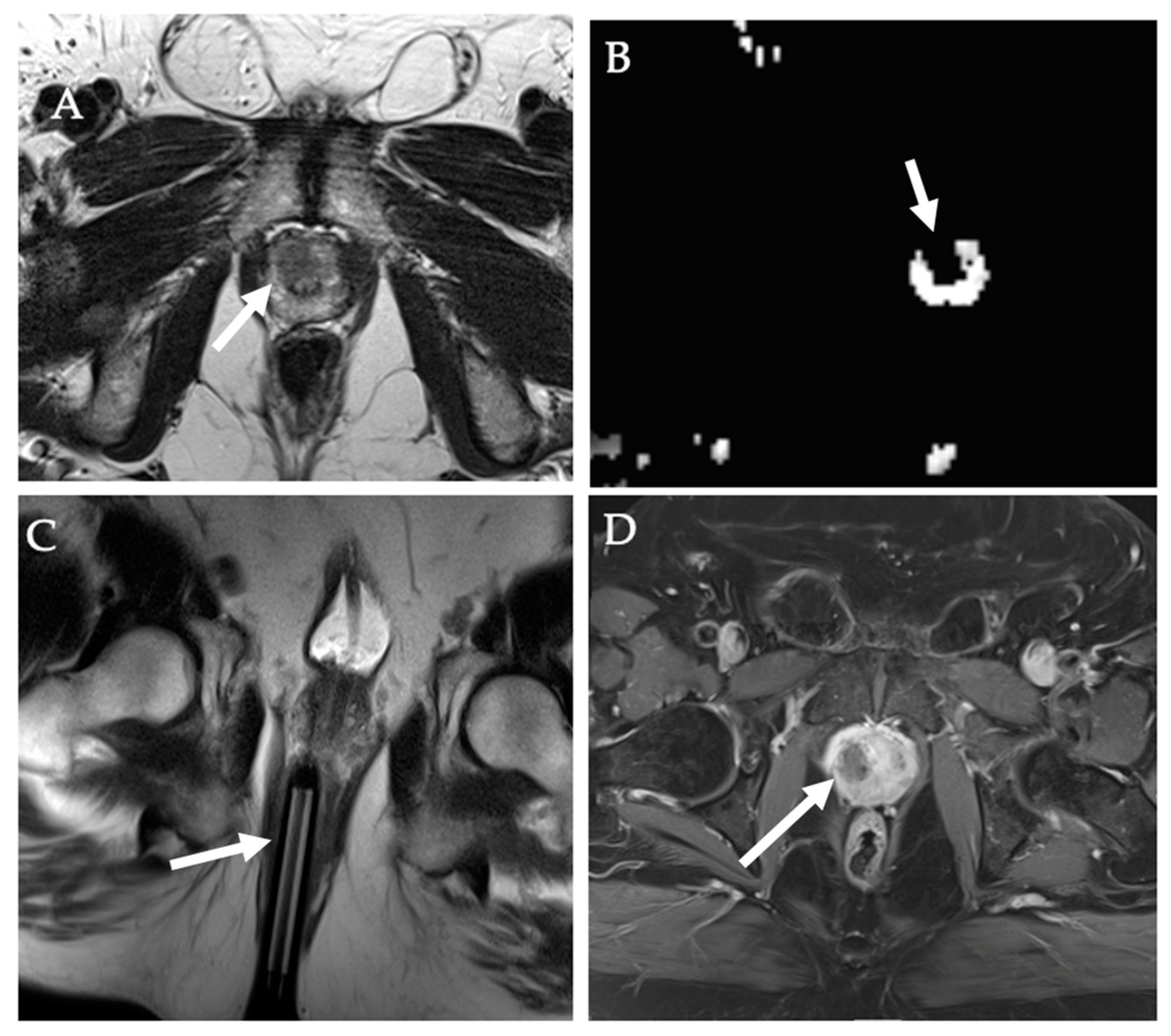 Diagnostics 12 01300 g014 550