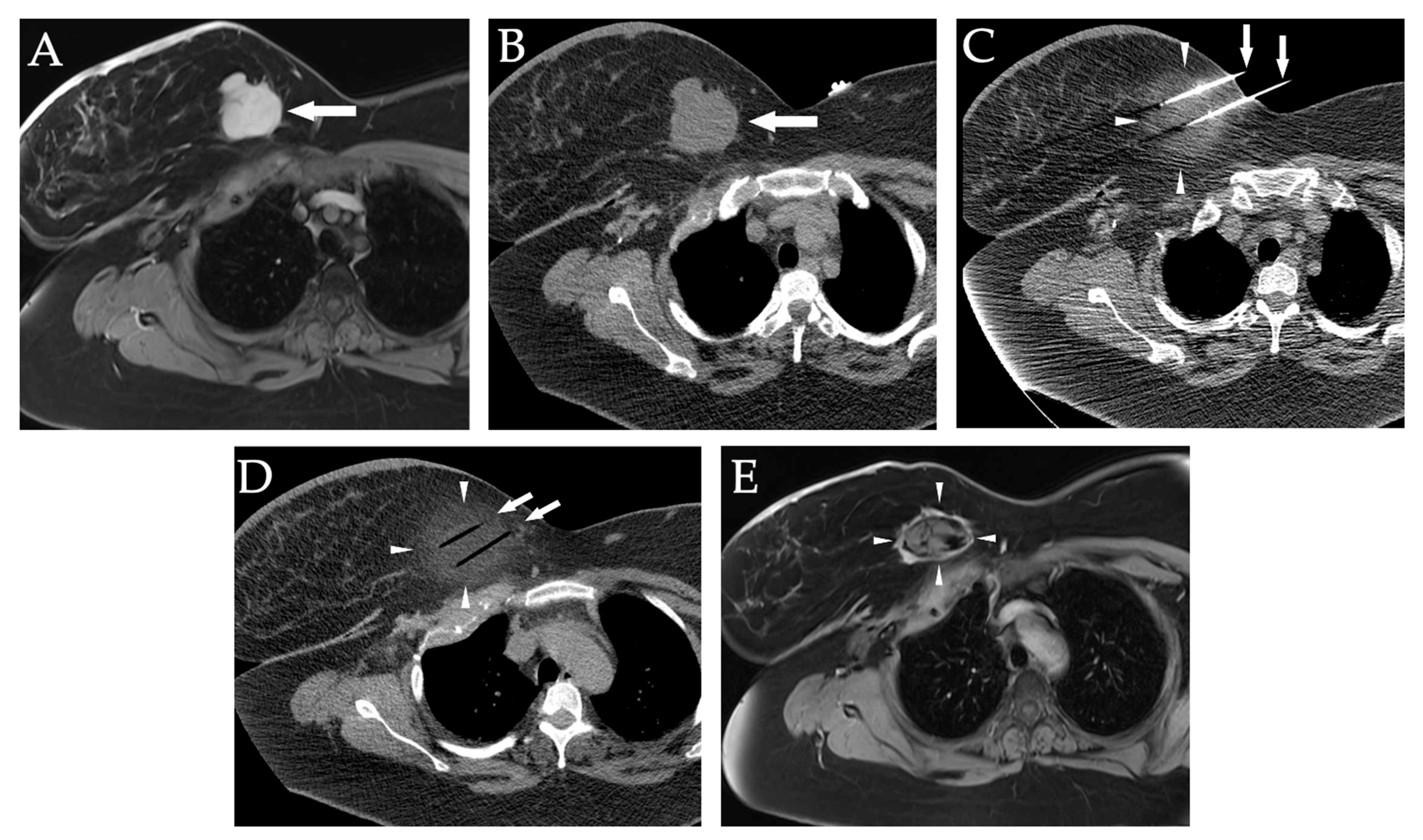 Diagnostics 12 01300 g018 550