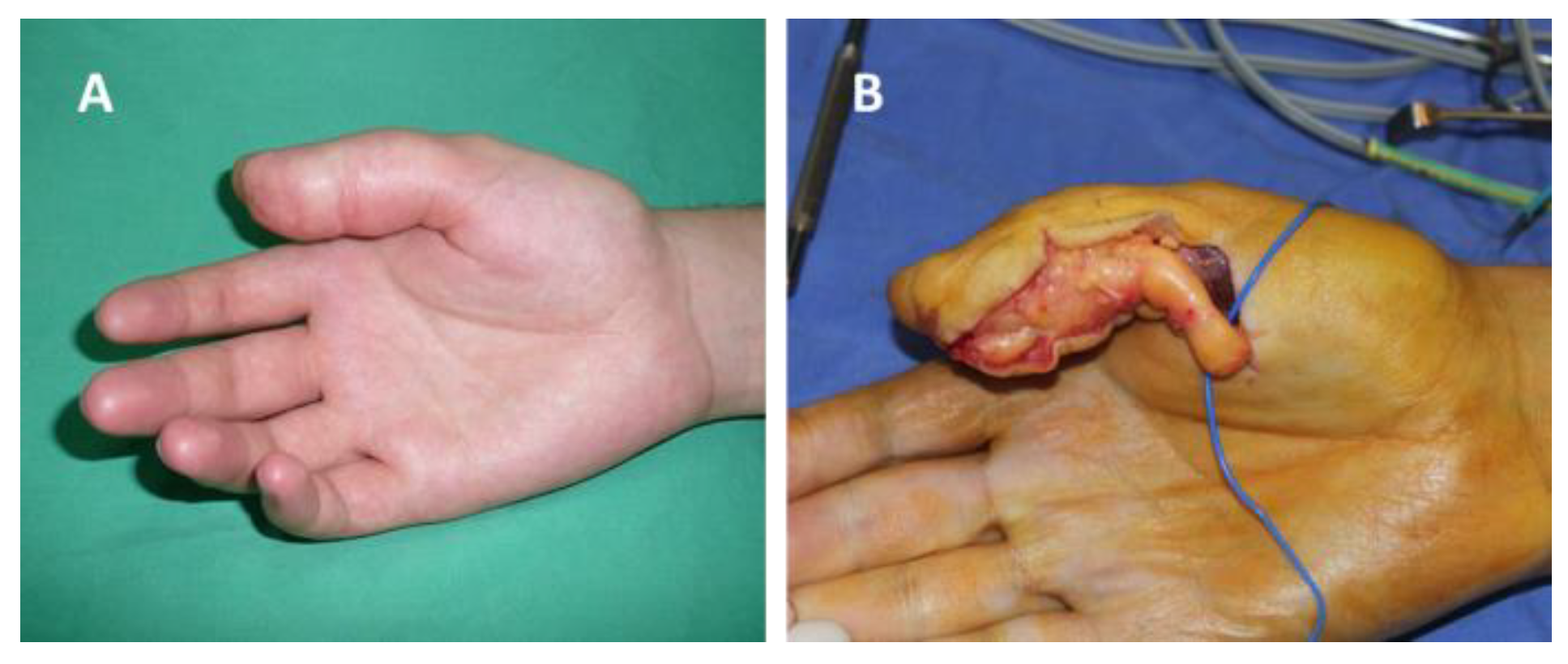 Diagnostics 12 01319 g001