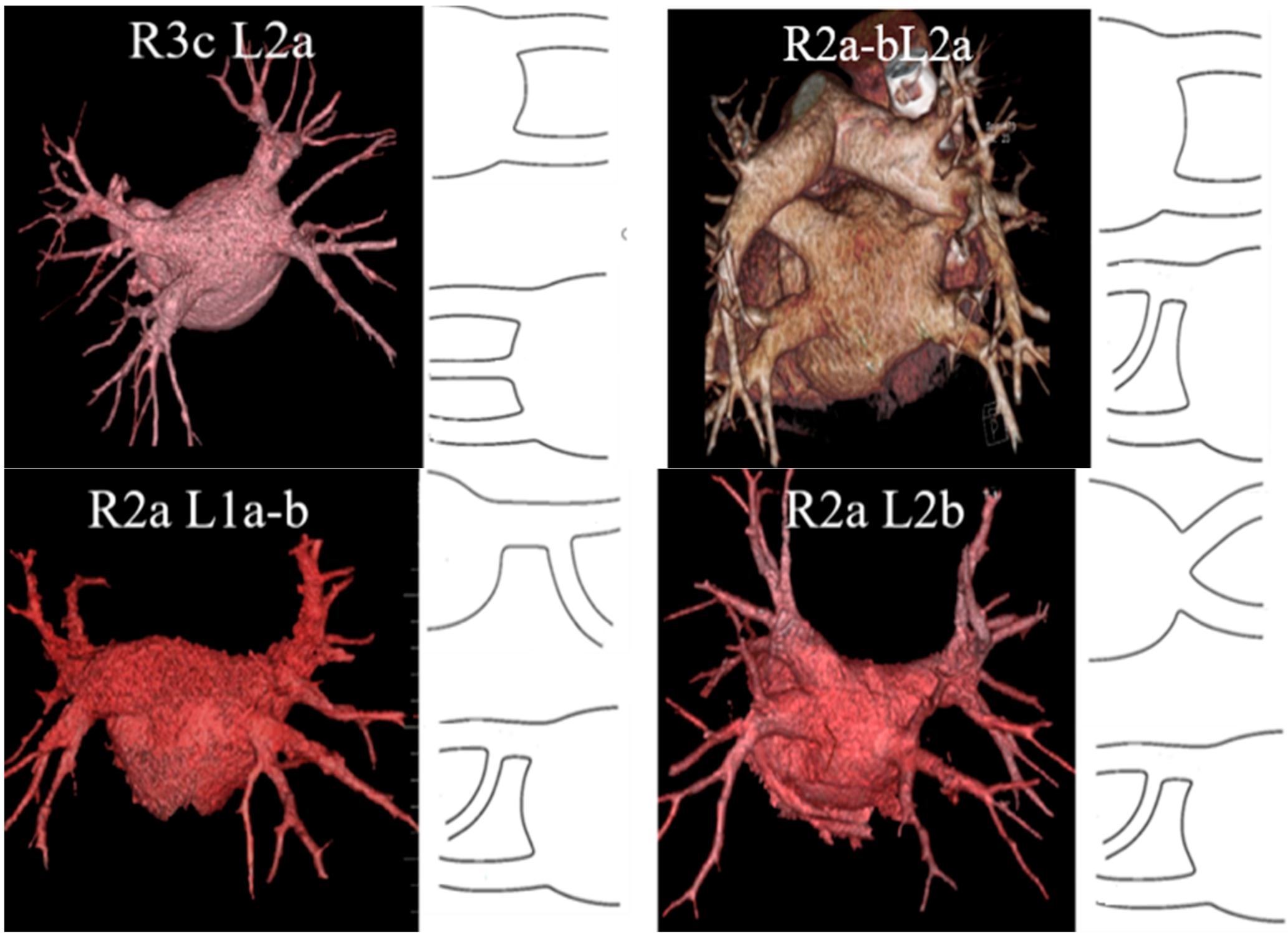 Diagnostics 12 01322 g003
