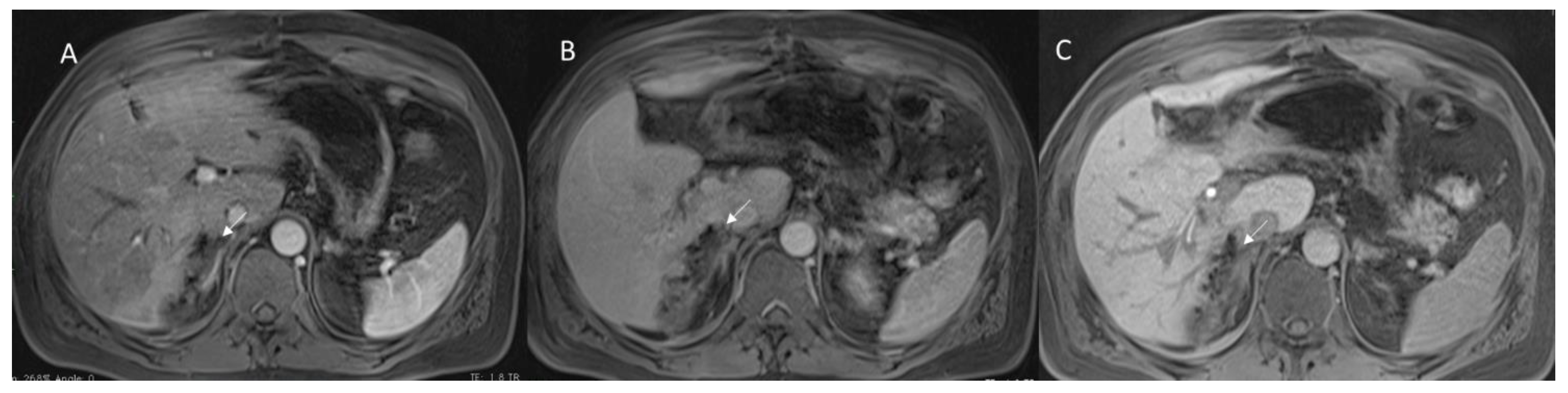 Diagnostics 12 01323 g002 Diagnostics 12 01323 g002