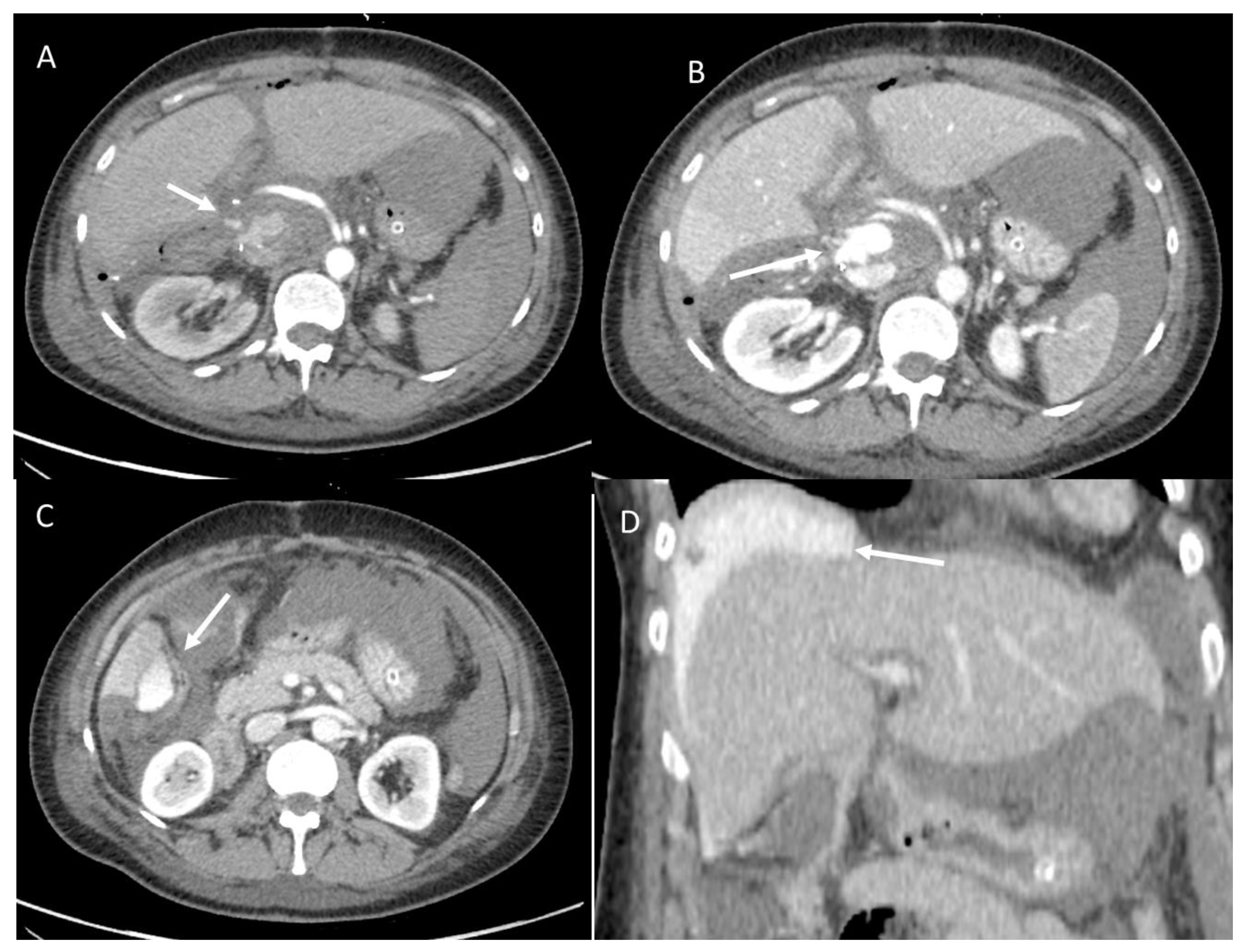 Diagnostics 12 01323 g005 Diagnostics 12 01323 g005