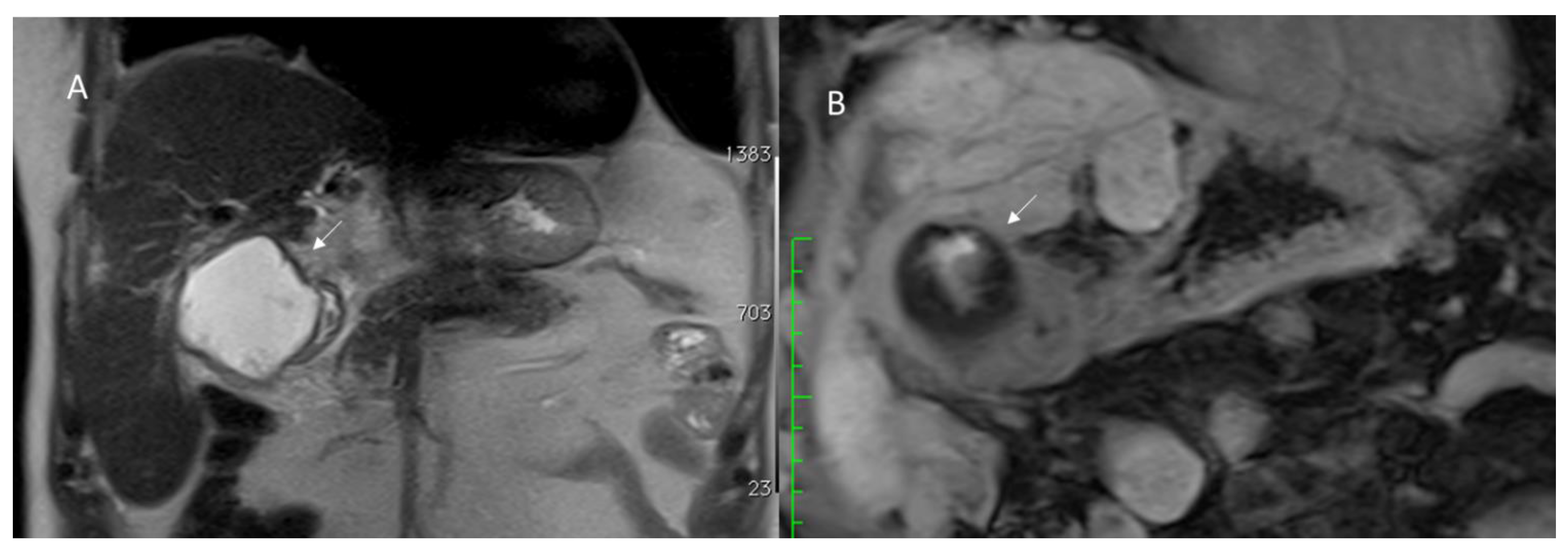Diagnostics 12 01323 g007 Diagnostics 12 01323 g007