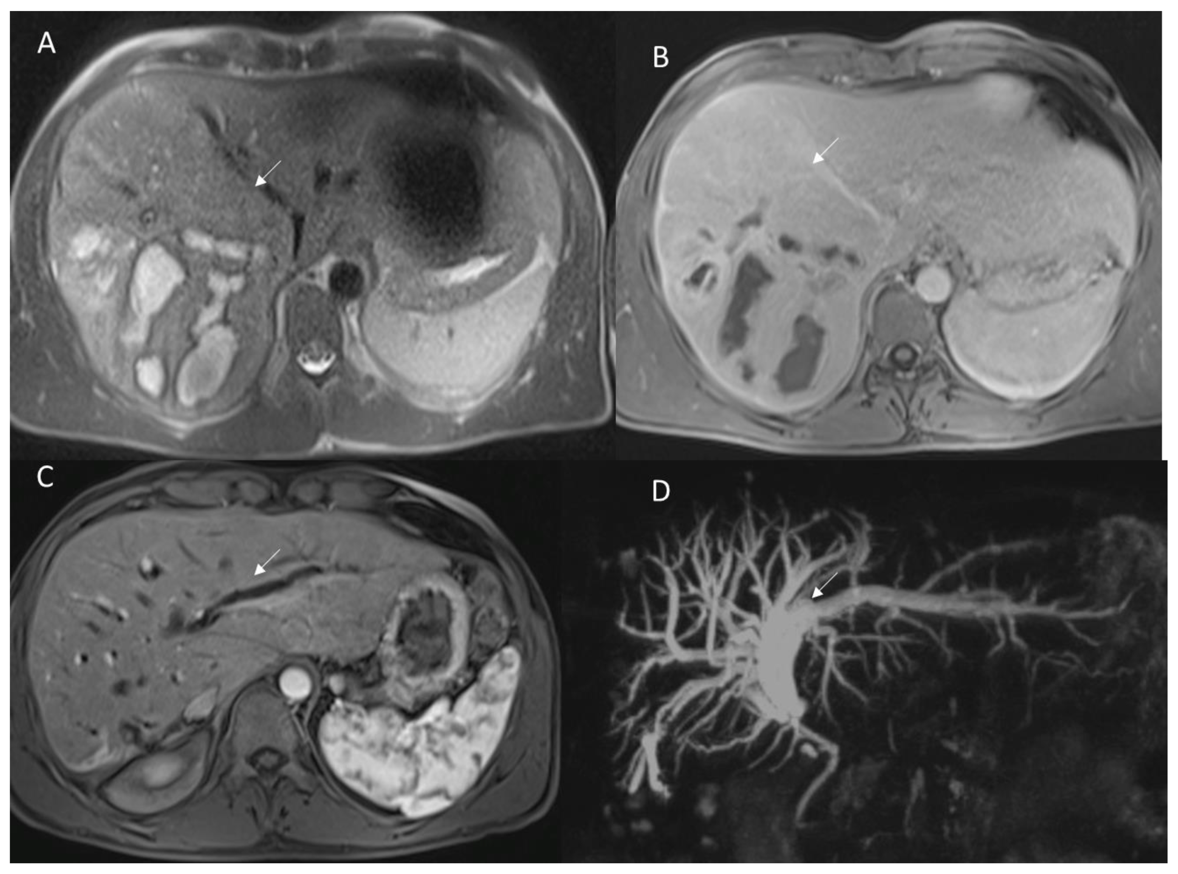 Diagnostics 12 01323 g009 Diagnostics 12 01323 g009