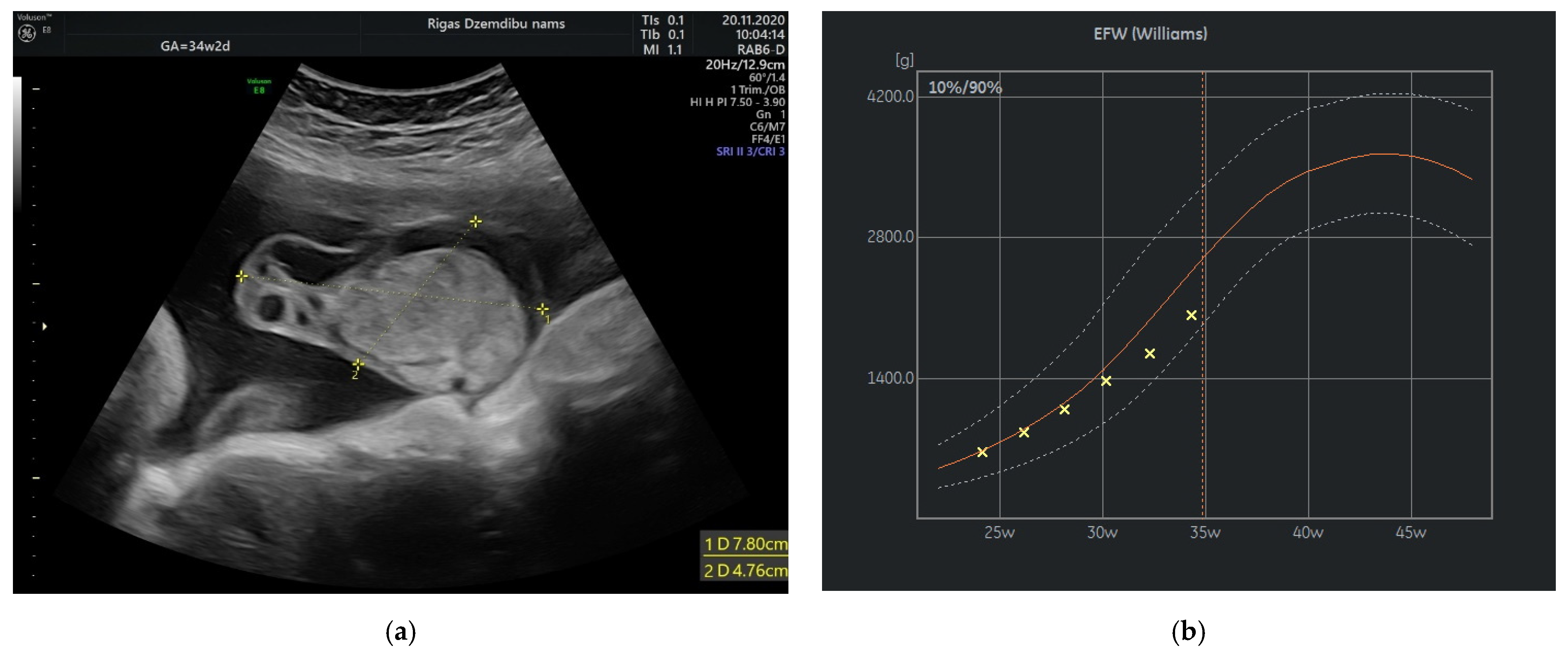 Diagnostics 12 01339 g003
