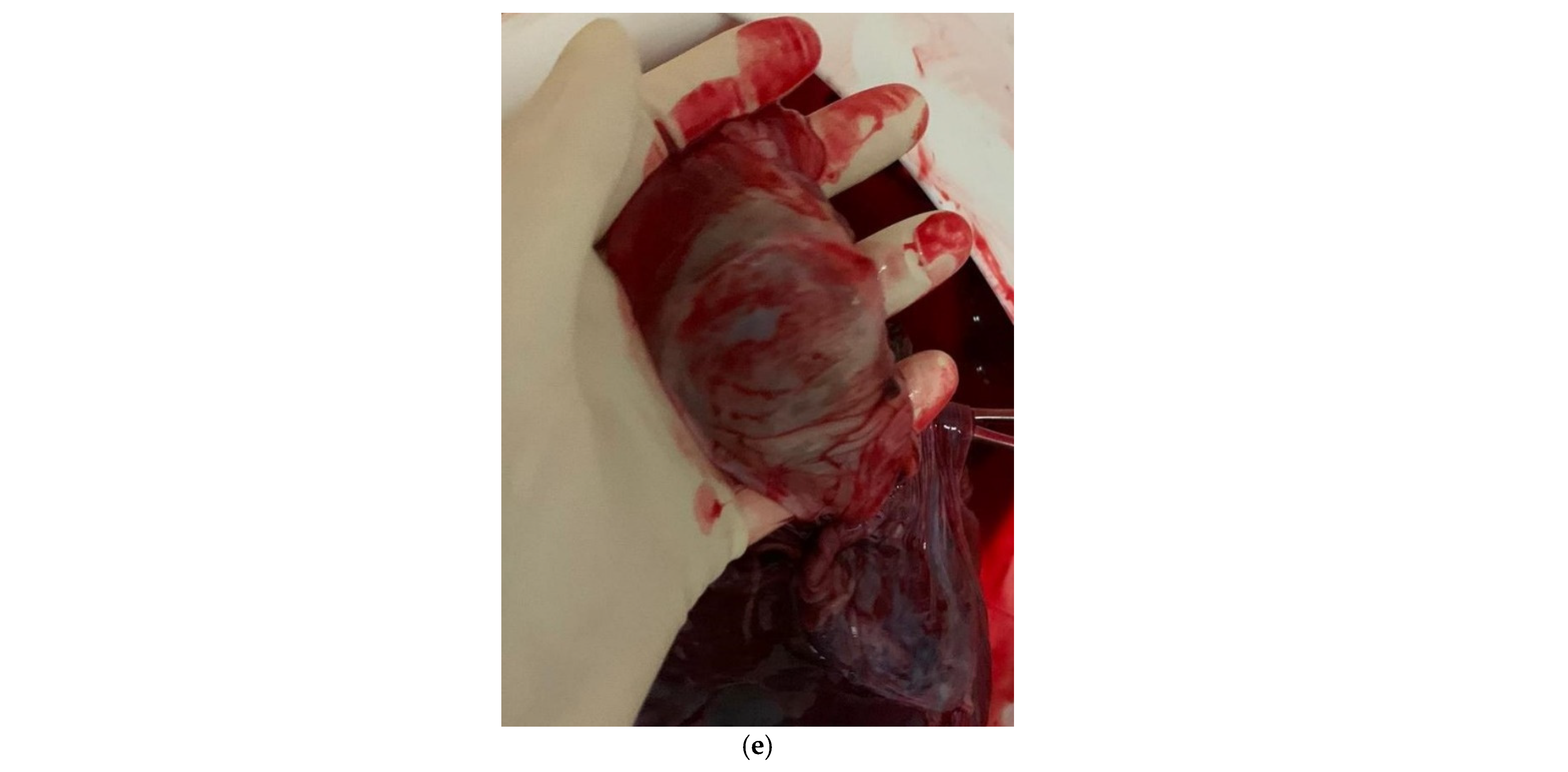 Diagnostics 12 01339 g004b