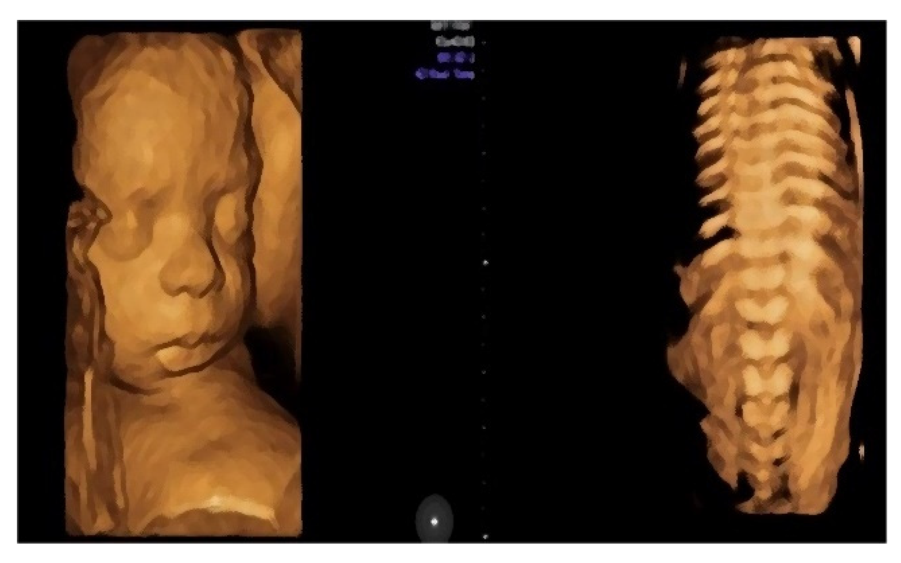 Diagnostics 12 01340 g003 550