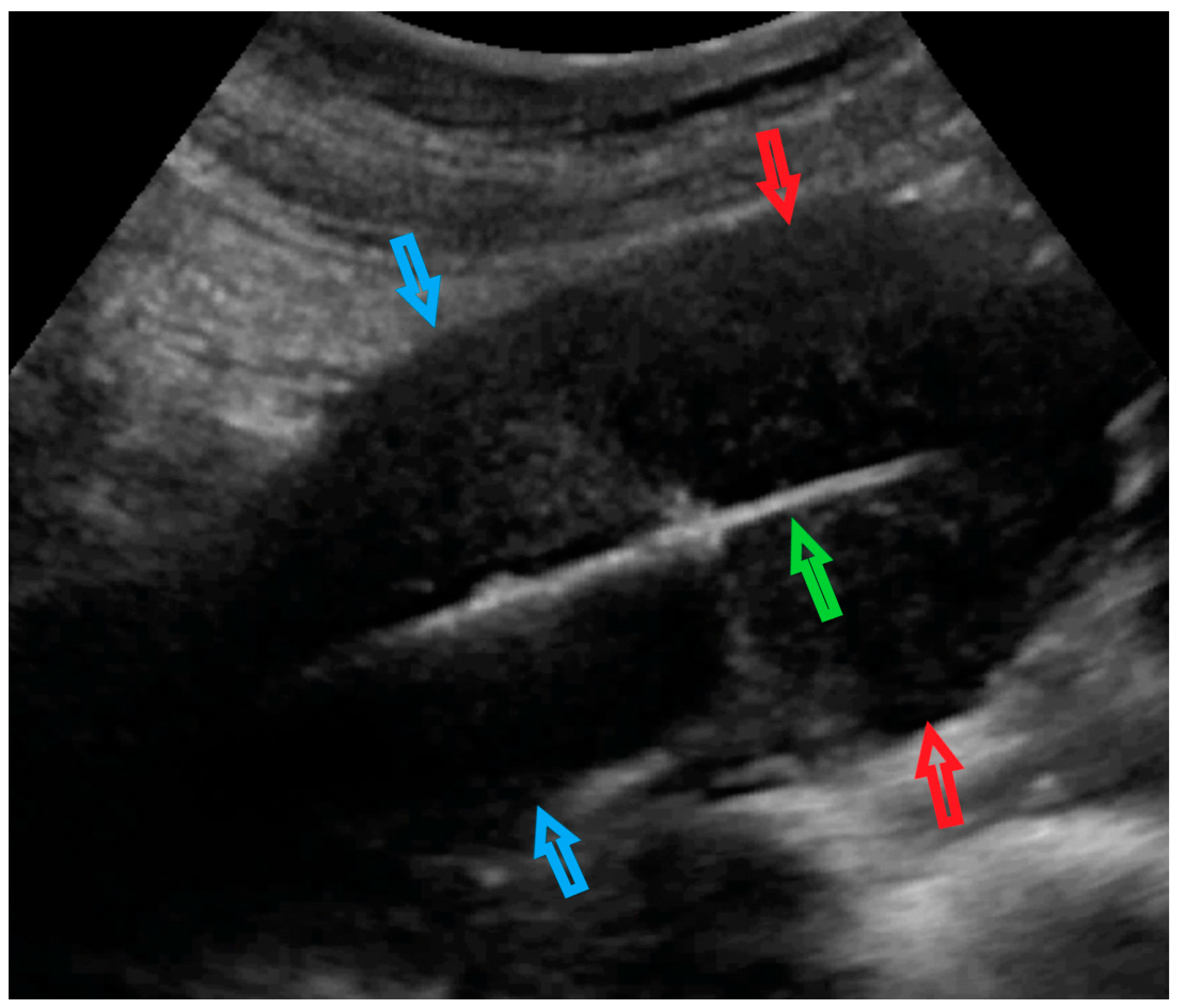 Diagnostics 12 01348 g003 550