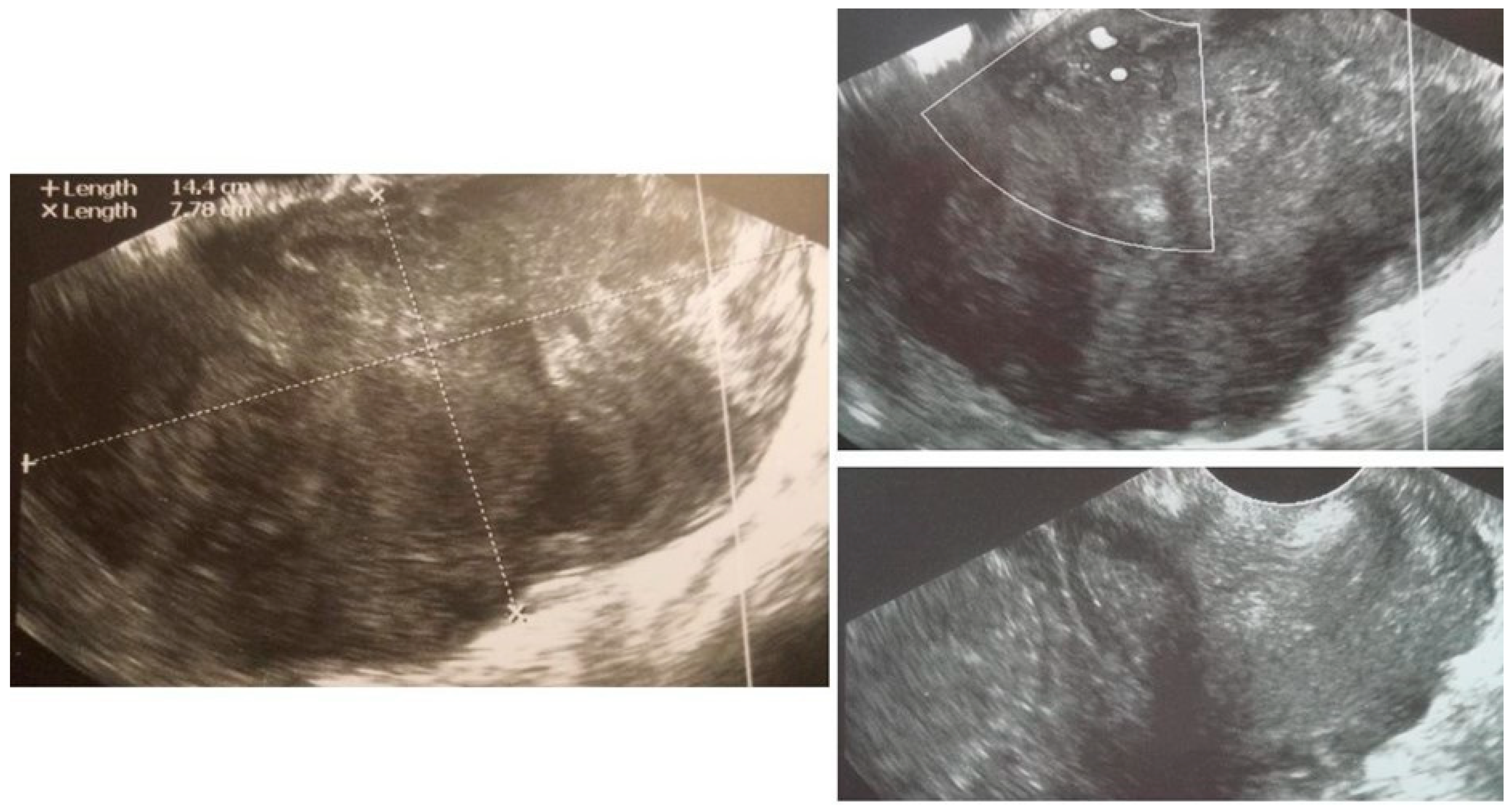 Diagnostics 12 01348 g0a2 550