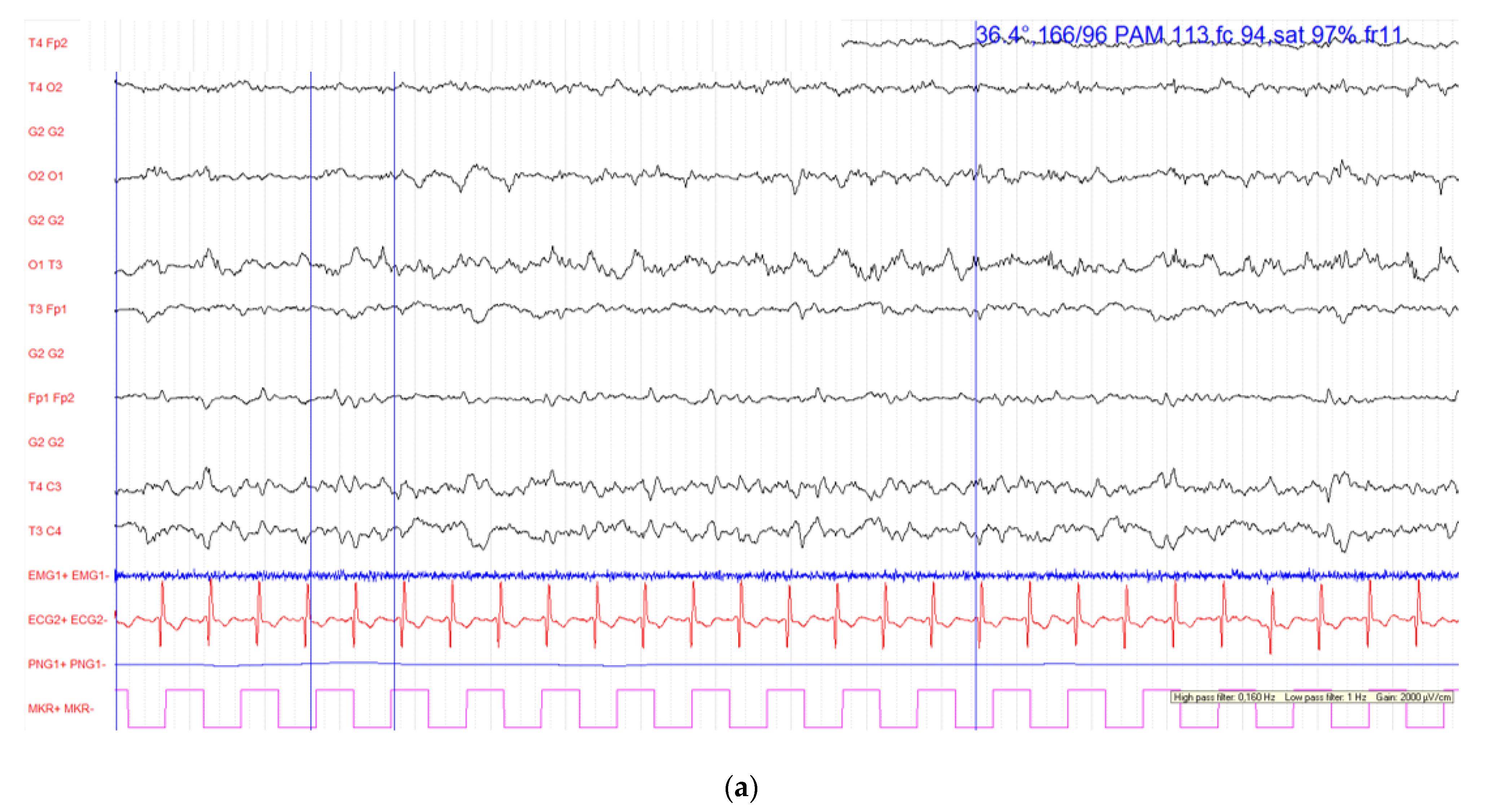 Diagnostics 12 01369 g001a 550