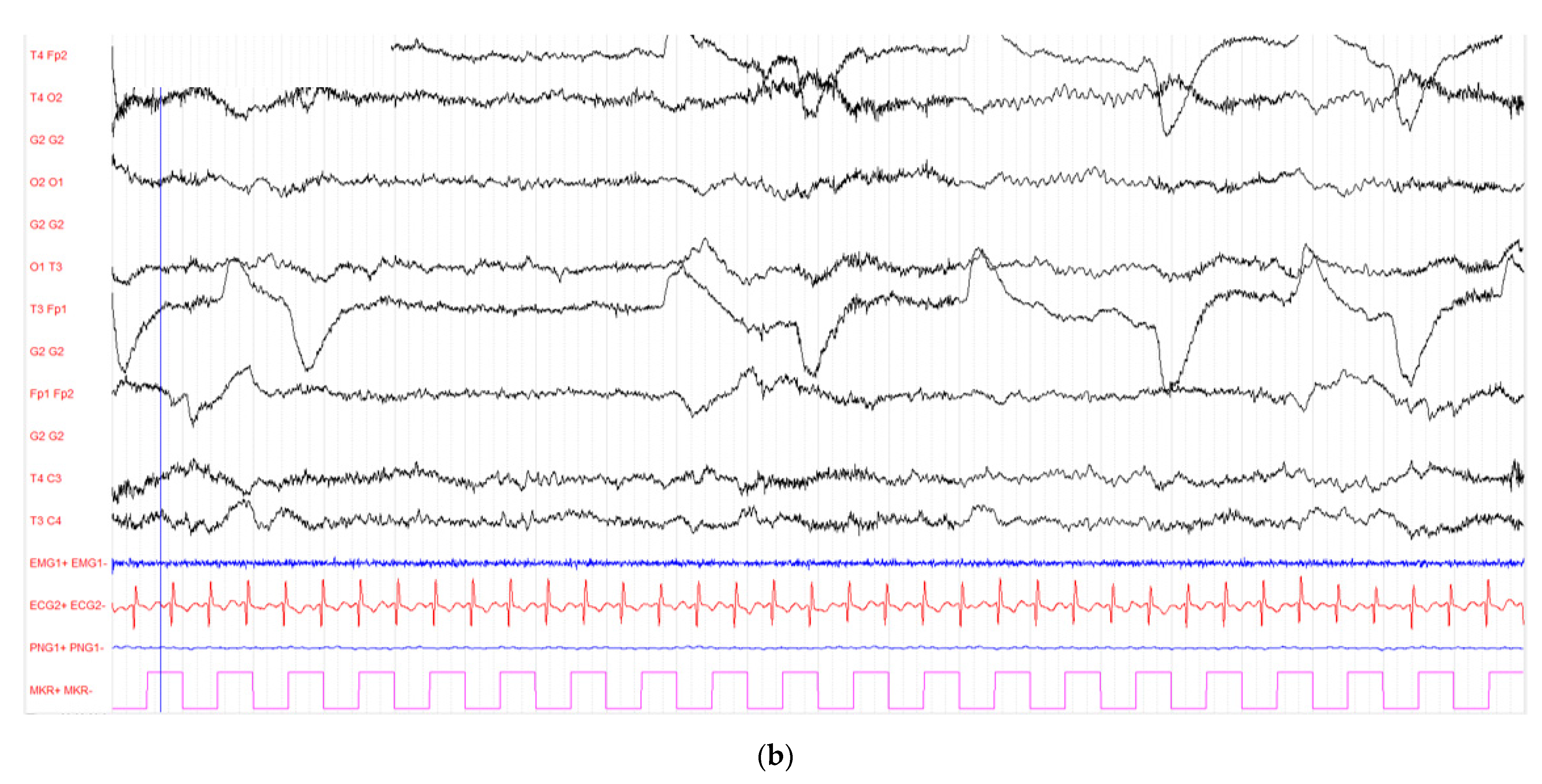 Diagnostics 12 01369 g001b 550