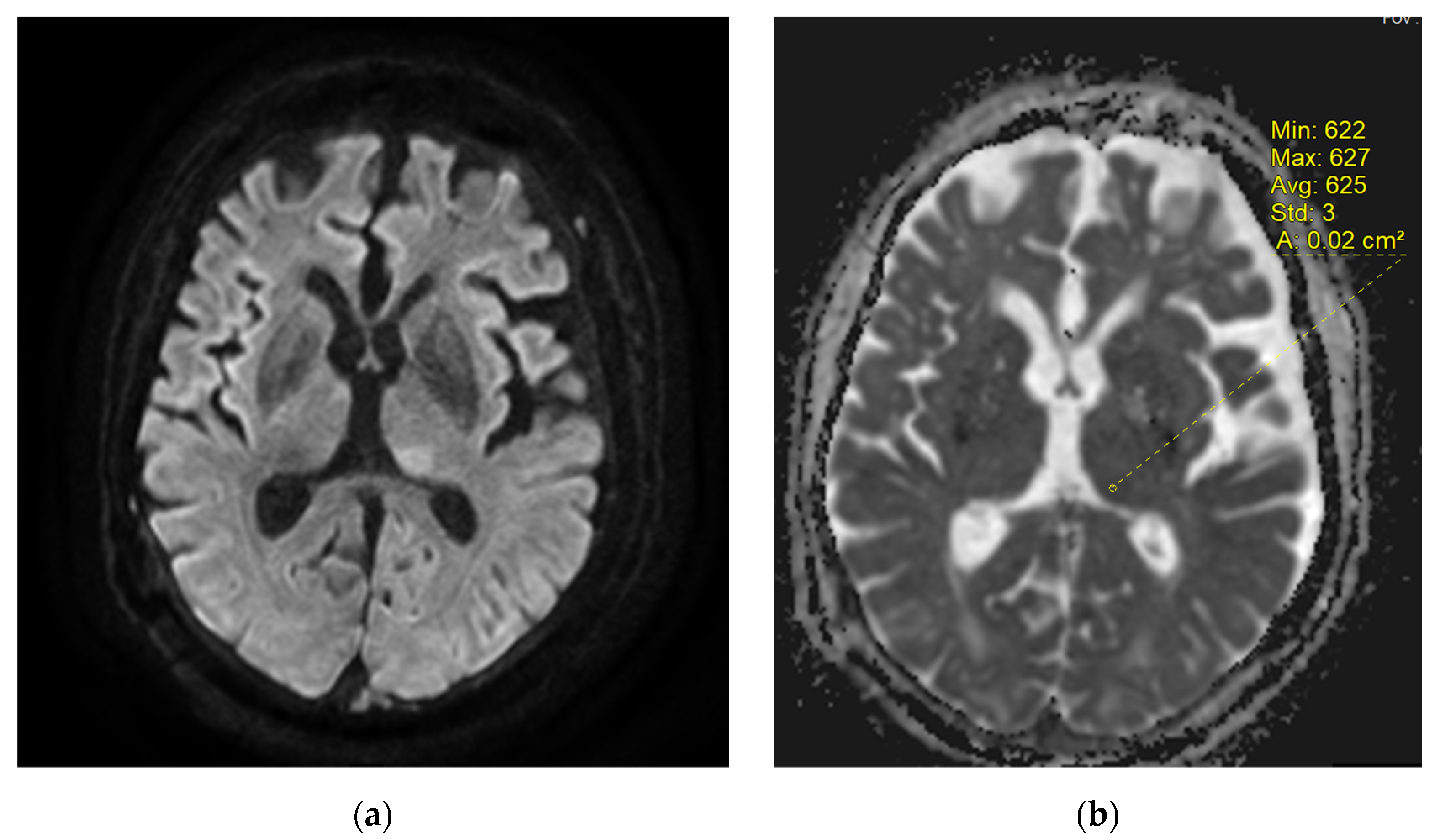 Diagnostics 12 01369 g003 550