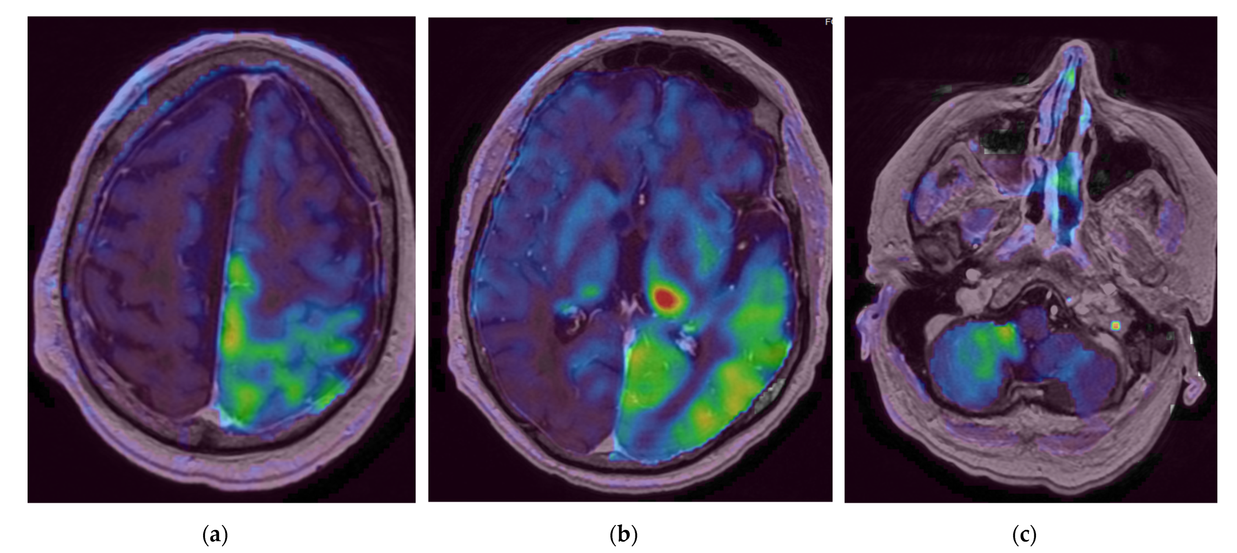Diagnostics 12 01369 g004 550
