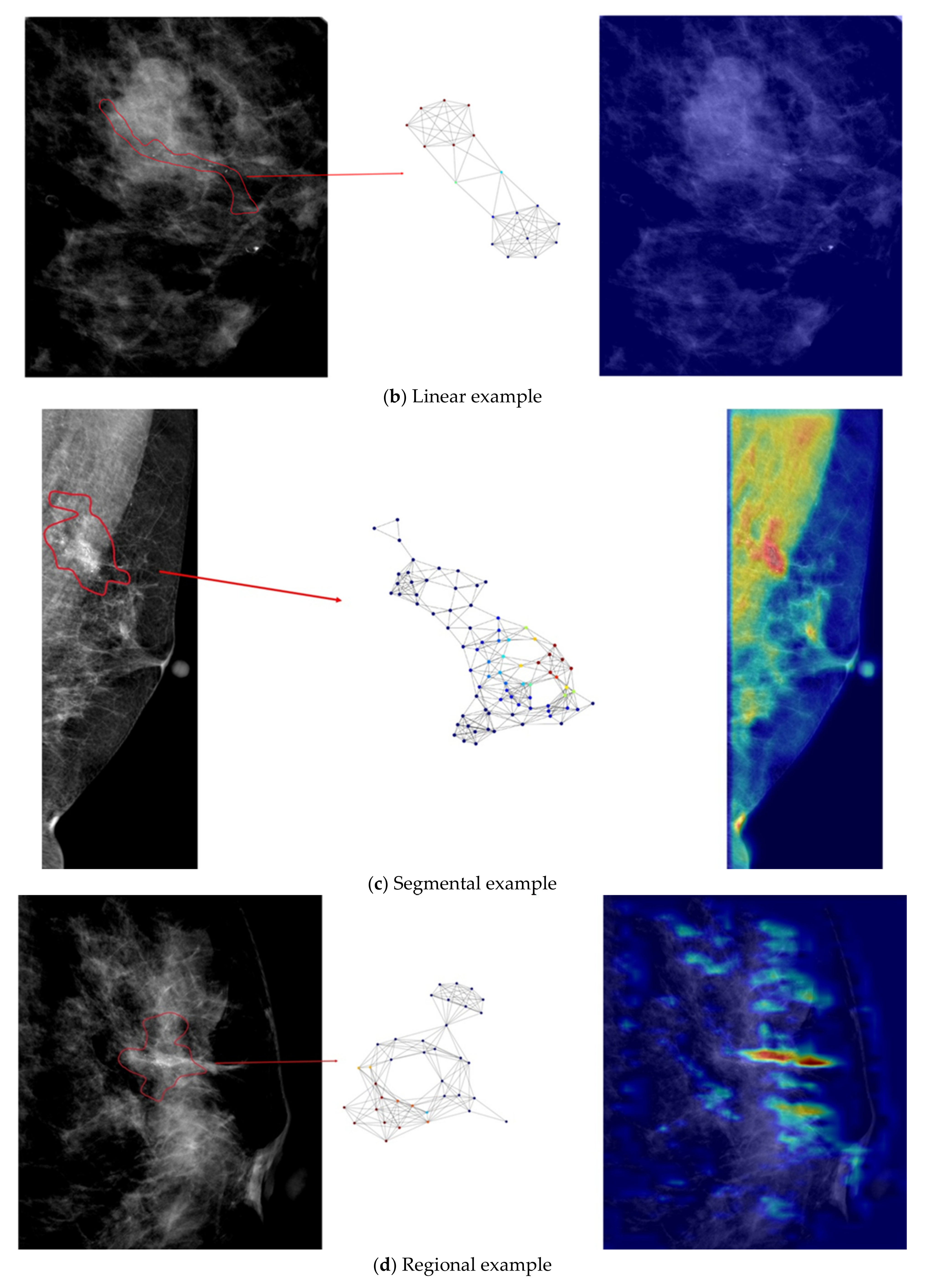 Diagnostics 12 01376 g005b Diagnostics 12 01376 g005b