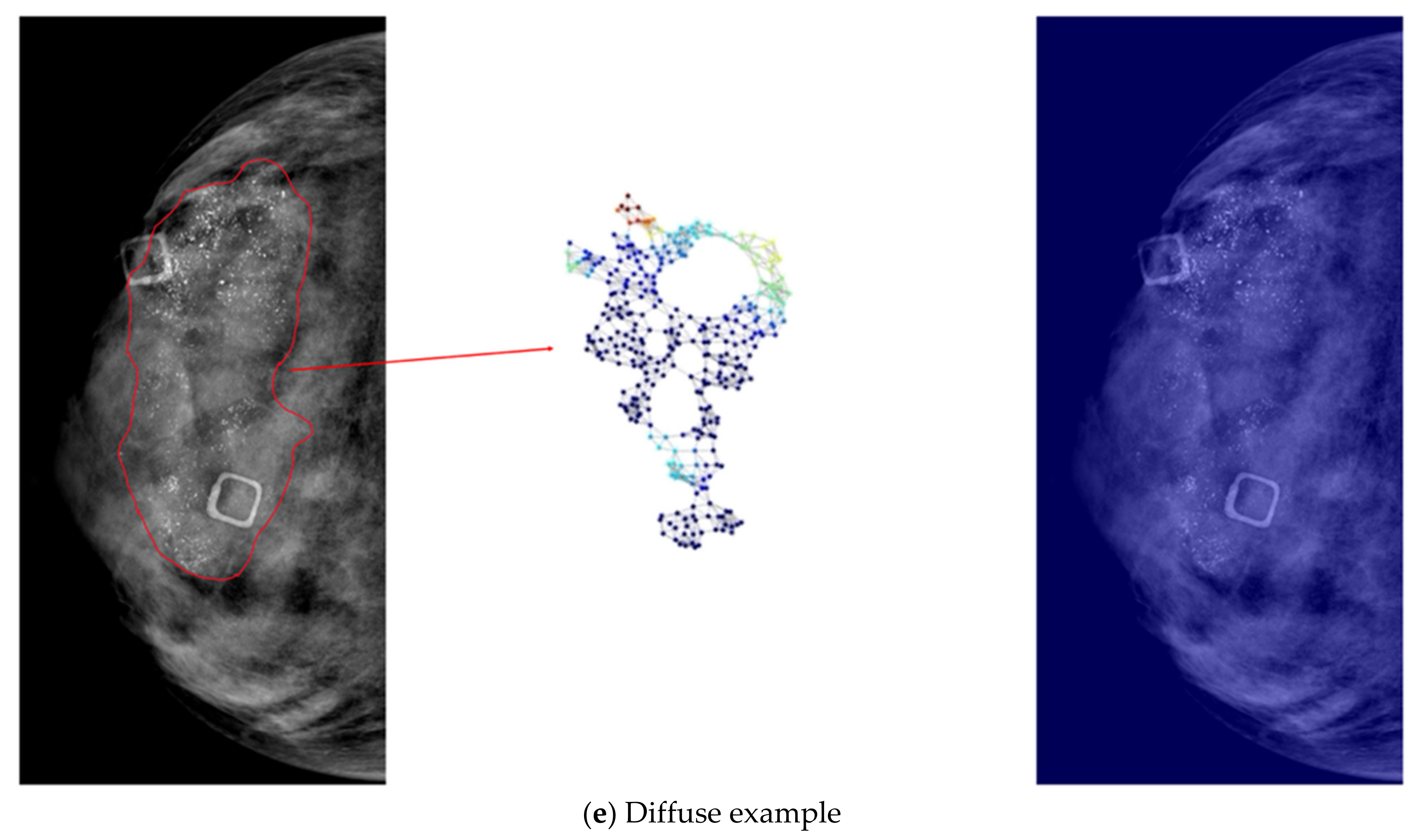 Diagnostics 12 01376 g005c Diagnostics 12 01376 g005c