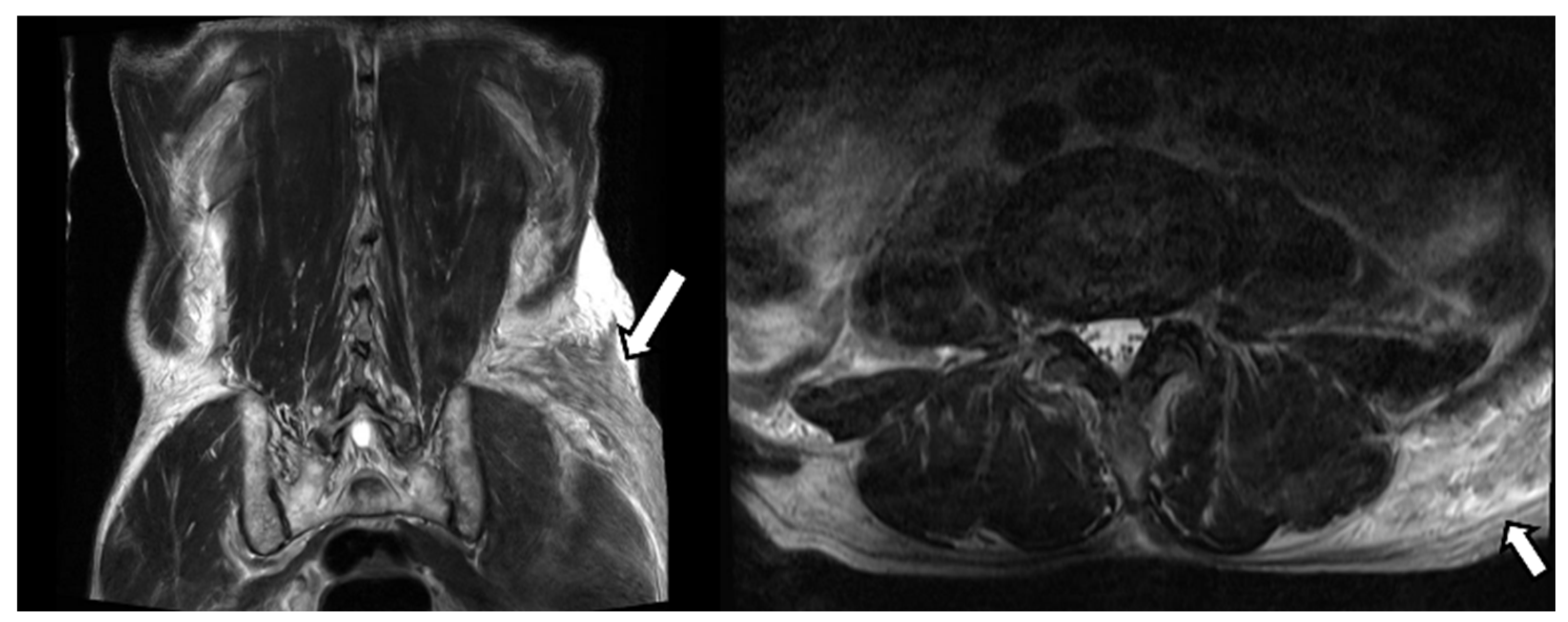 Diagnostics 12 01383 g001