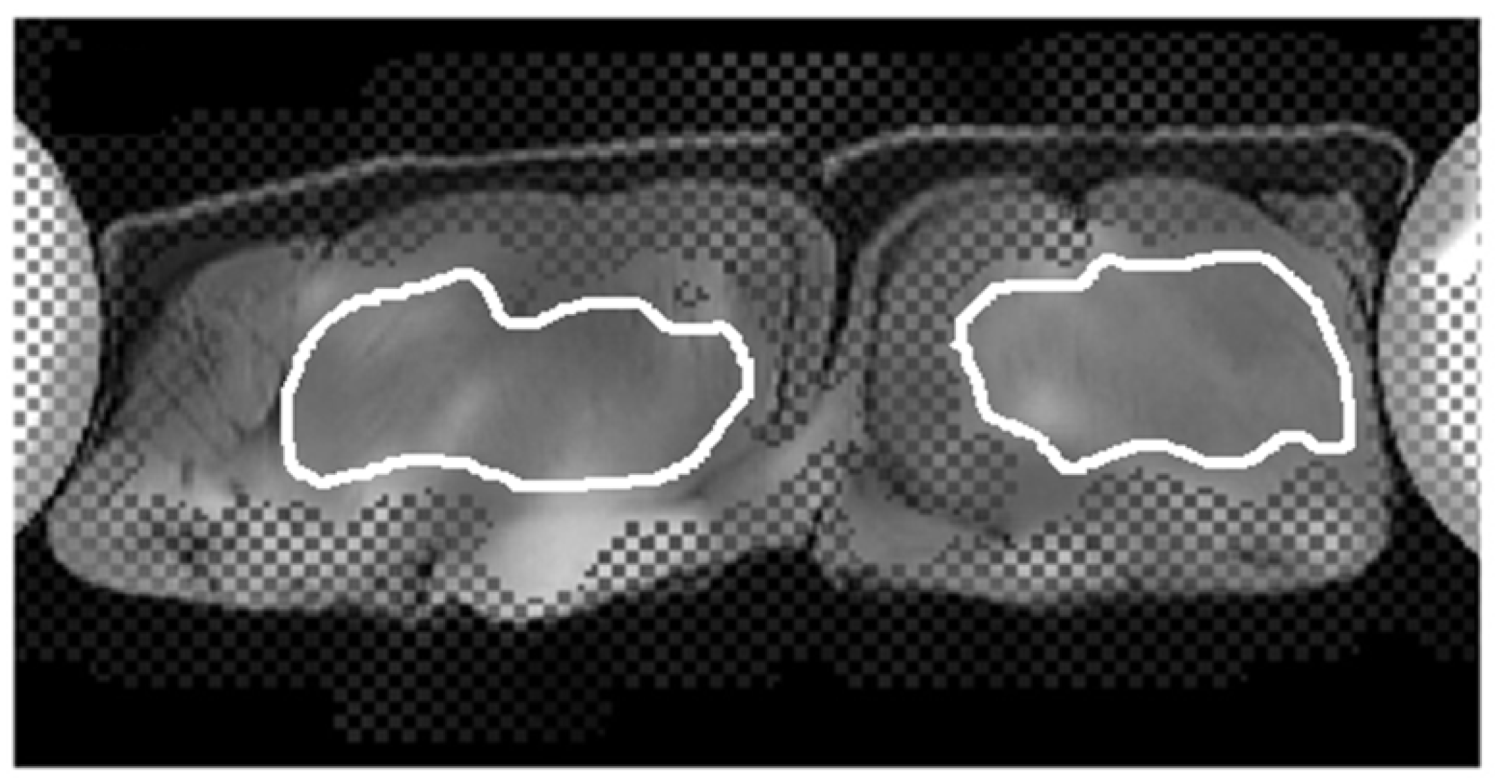 Diagnostics 12 01385 g004 550