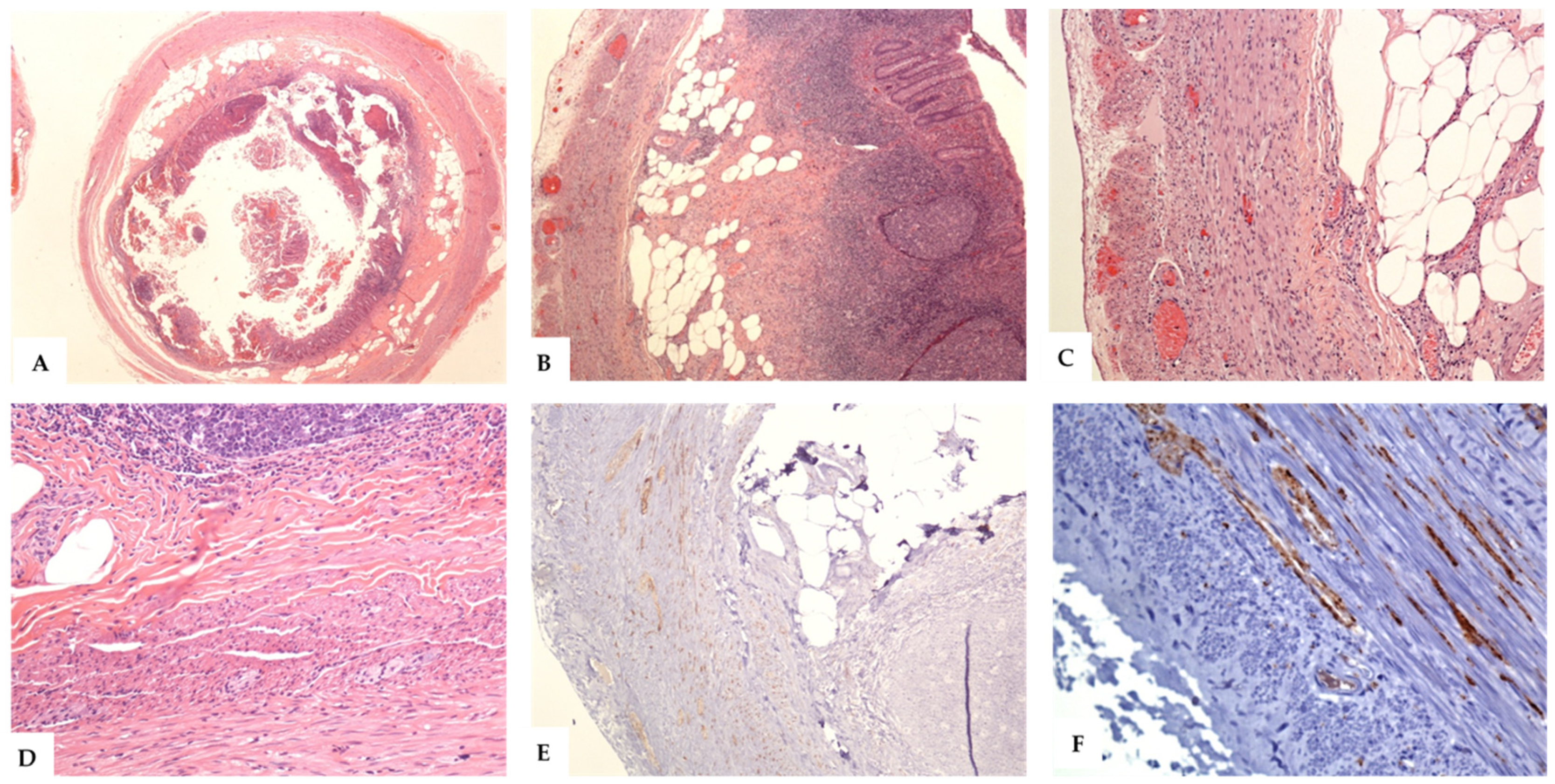 Diagnostics 12 01386 g004