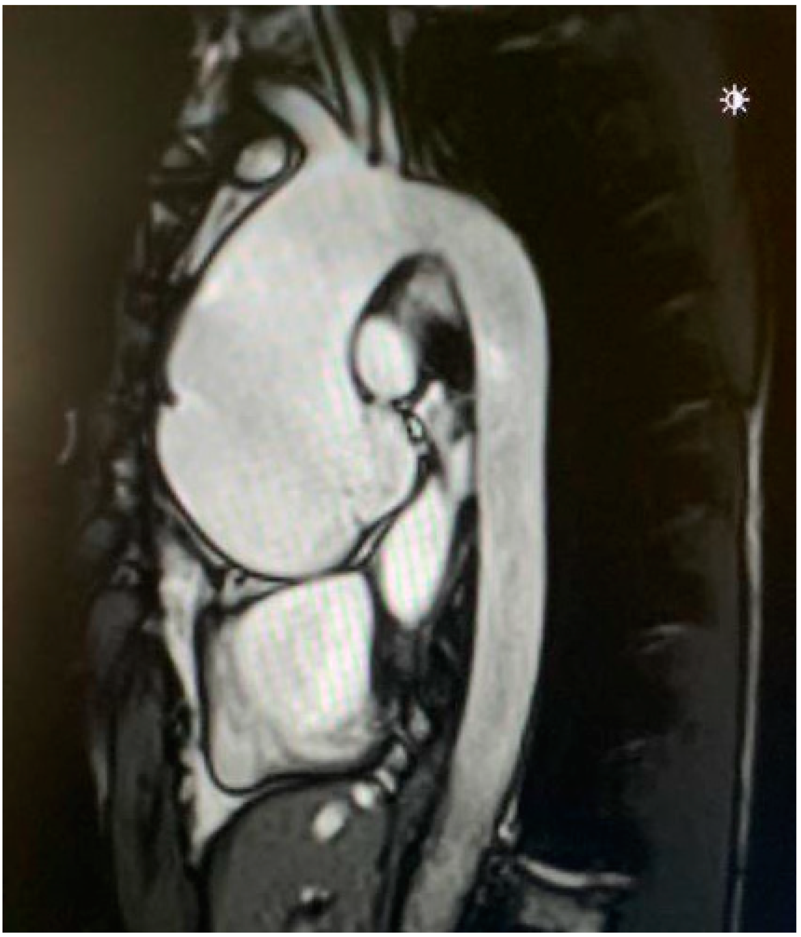 Diagnostics 12 01392 g005