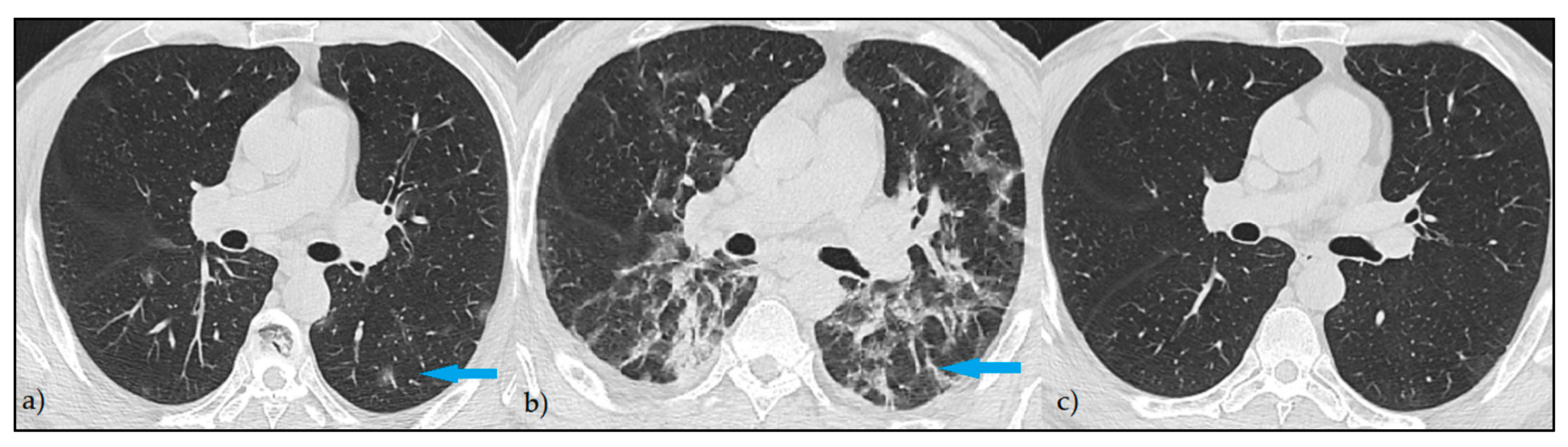 Diagnostics 12 01397 g002