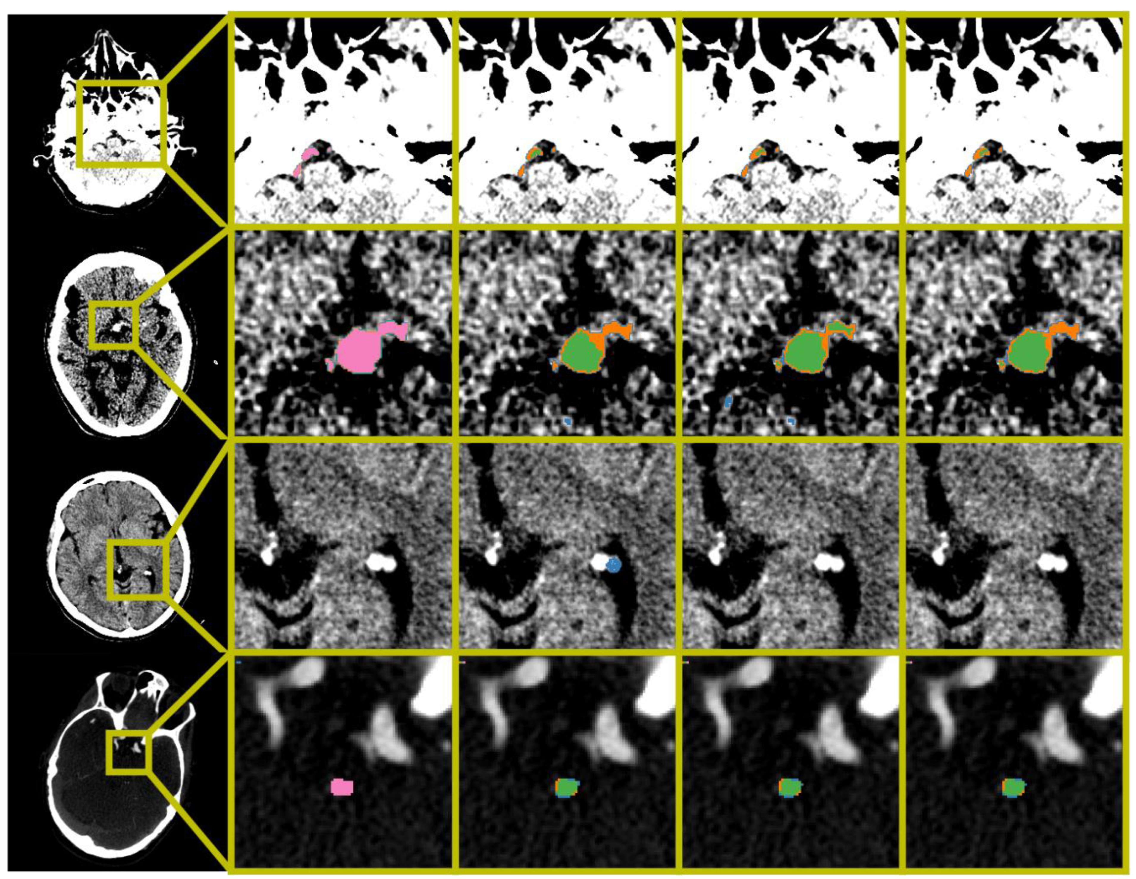 Diagnostics 12 01400 g002 Diagnostics 12 01400 g002
