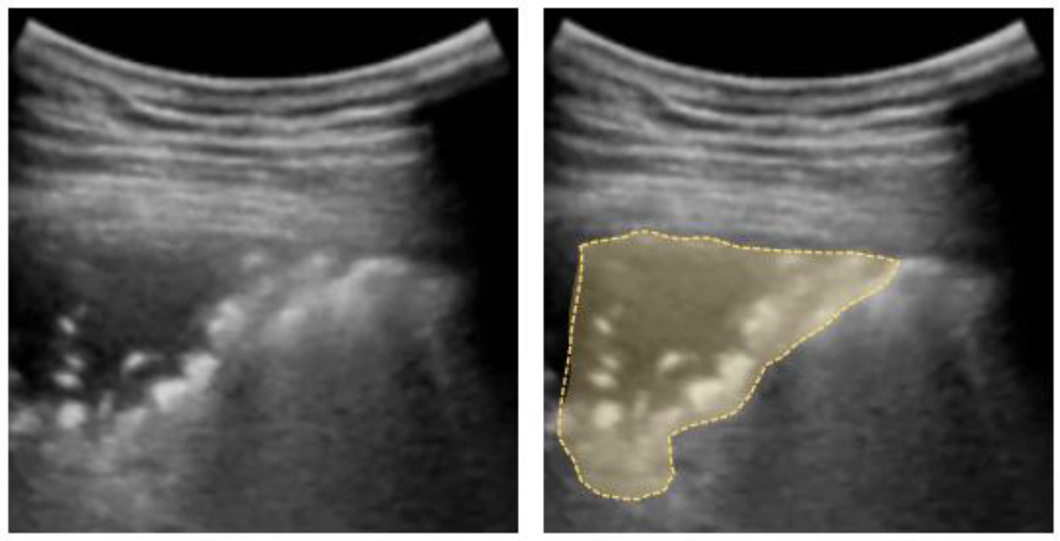 Diagnostics 12 01405 g006 Diagnostics 12 01405 g006