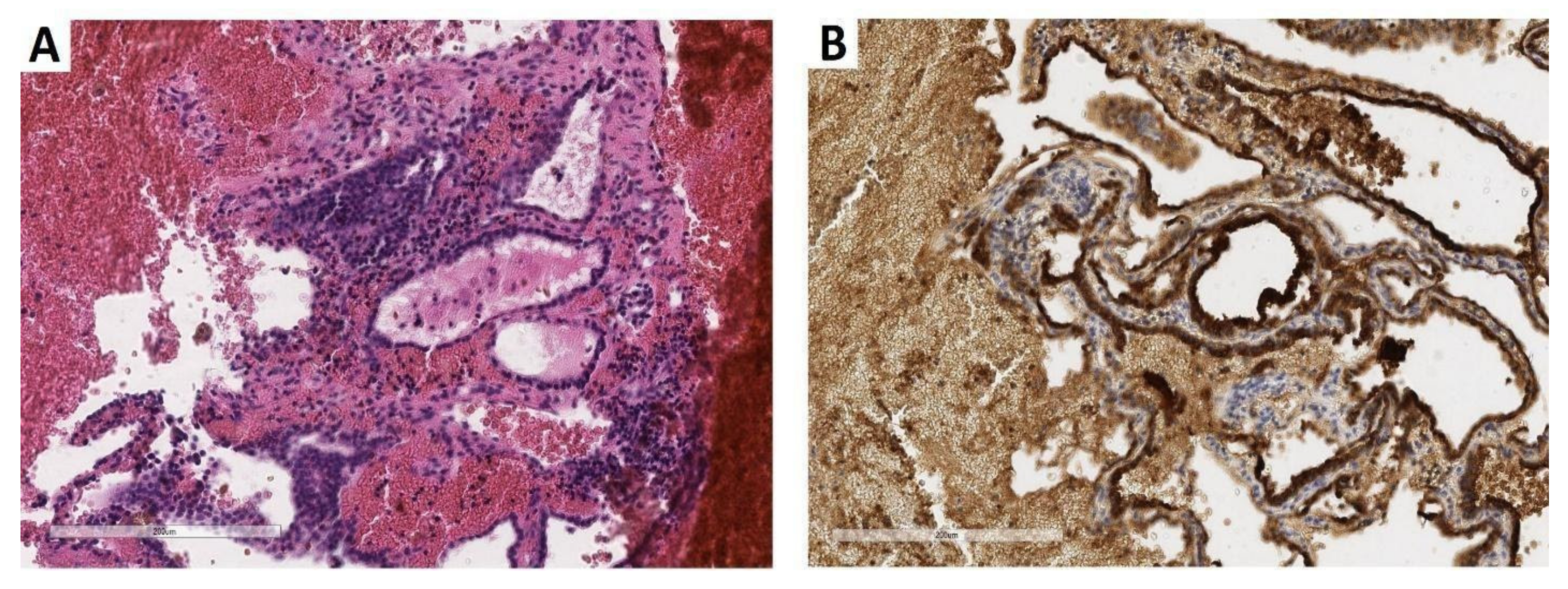 Diagnostics 12 01411 g001