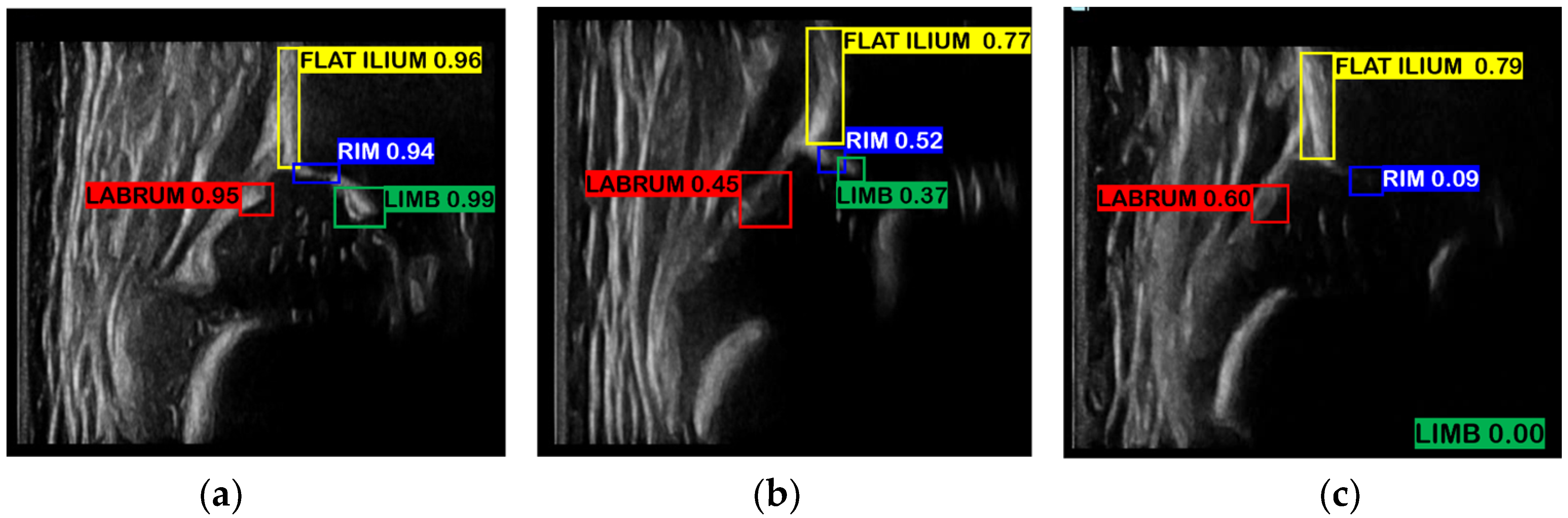 Diagnostics 12 01423 g004