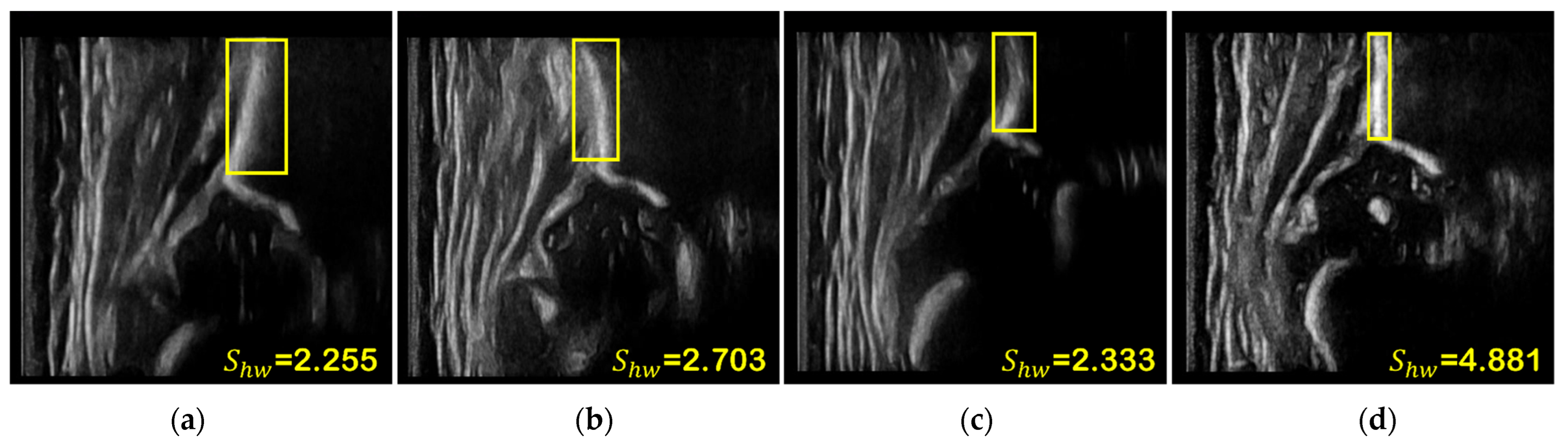 Diagnostics 12 01423 g005