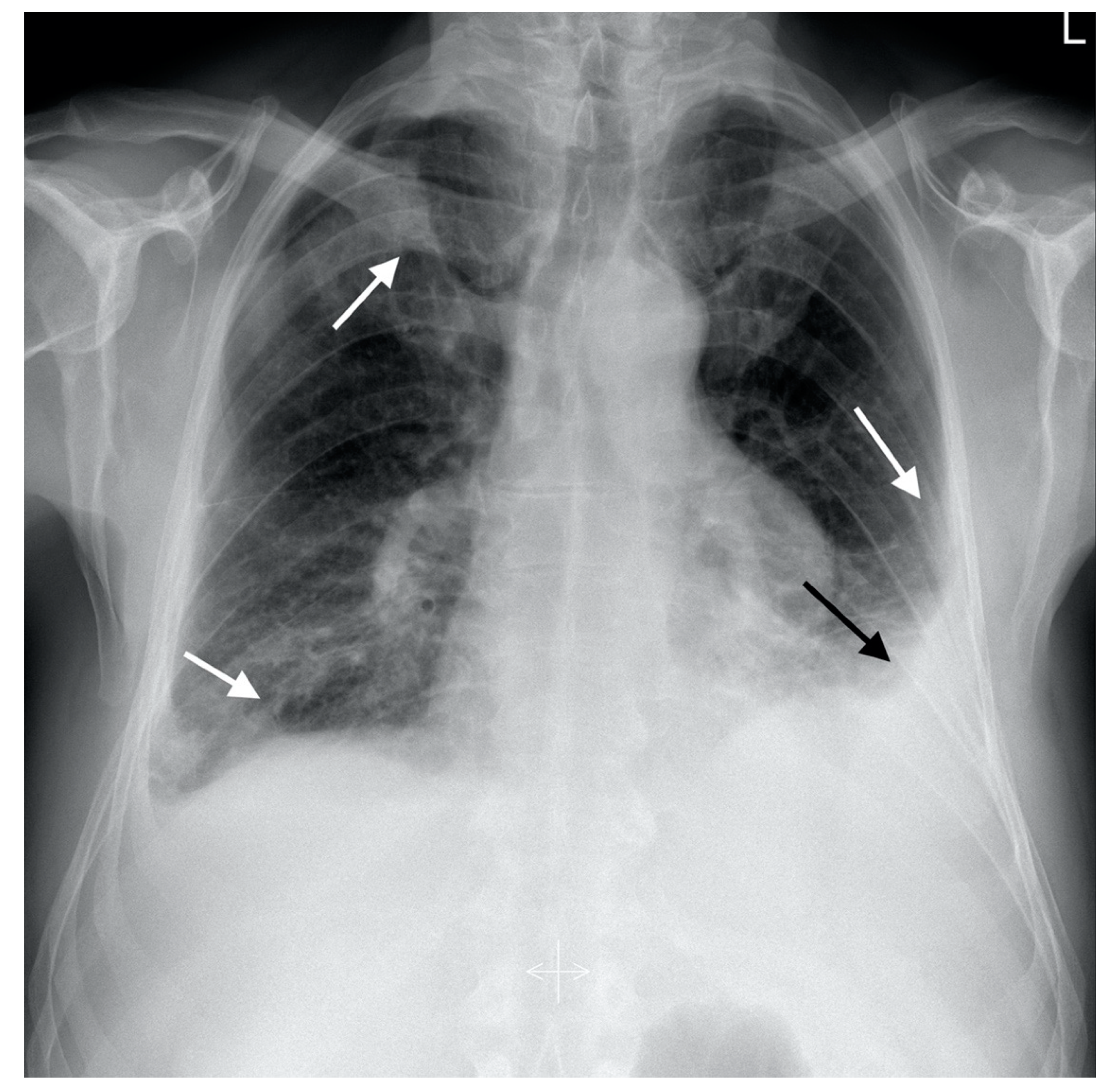 Diagnostics 12 01425 g001