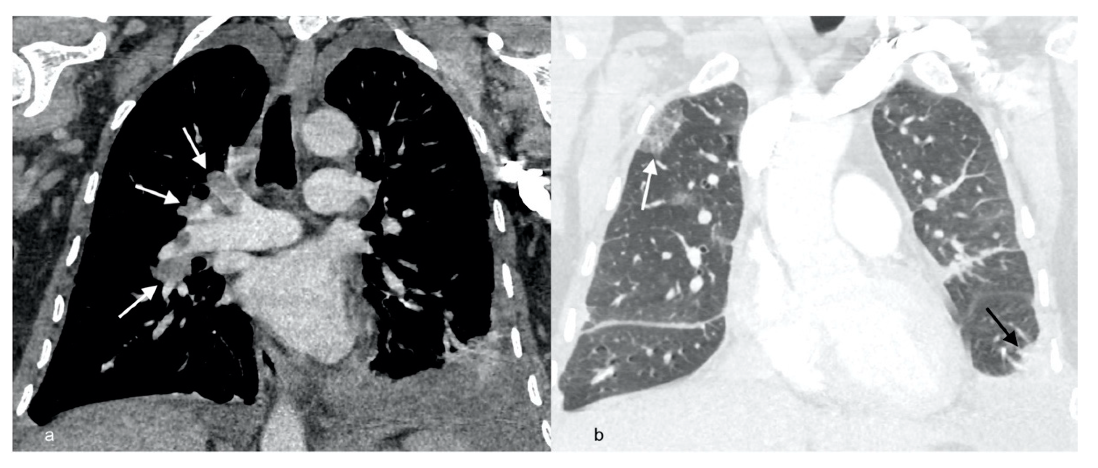 Diagnostics 12 01425 g002