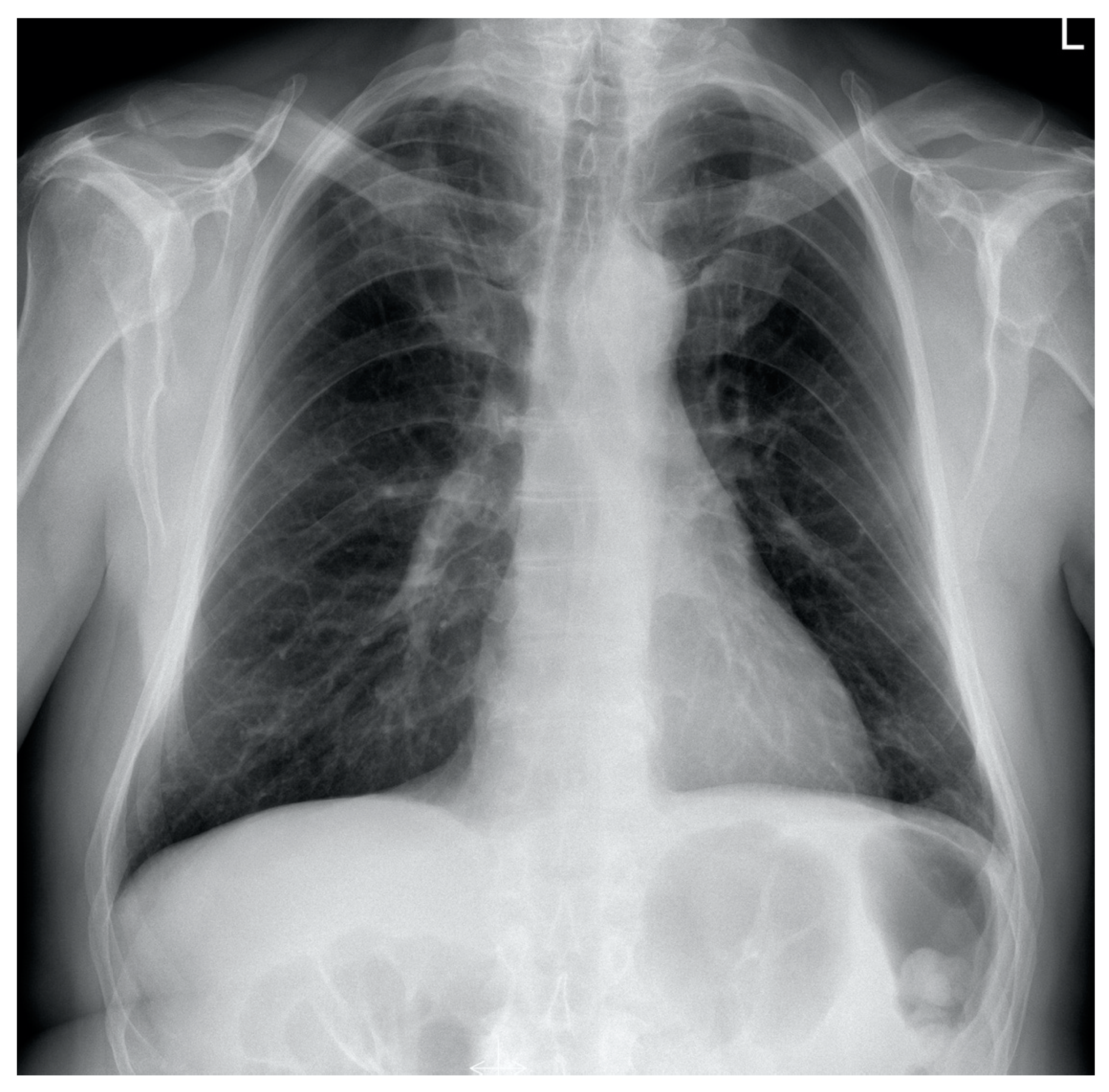 Diagnostics 12 01425 g003