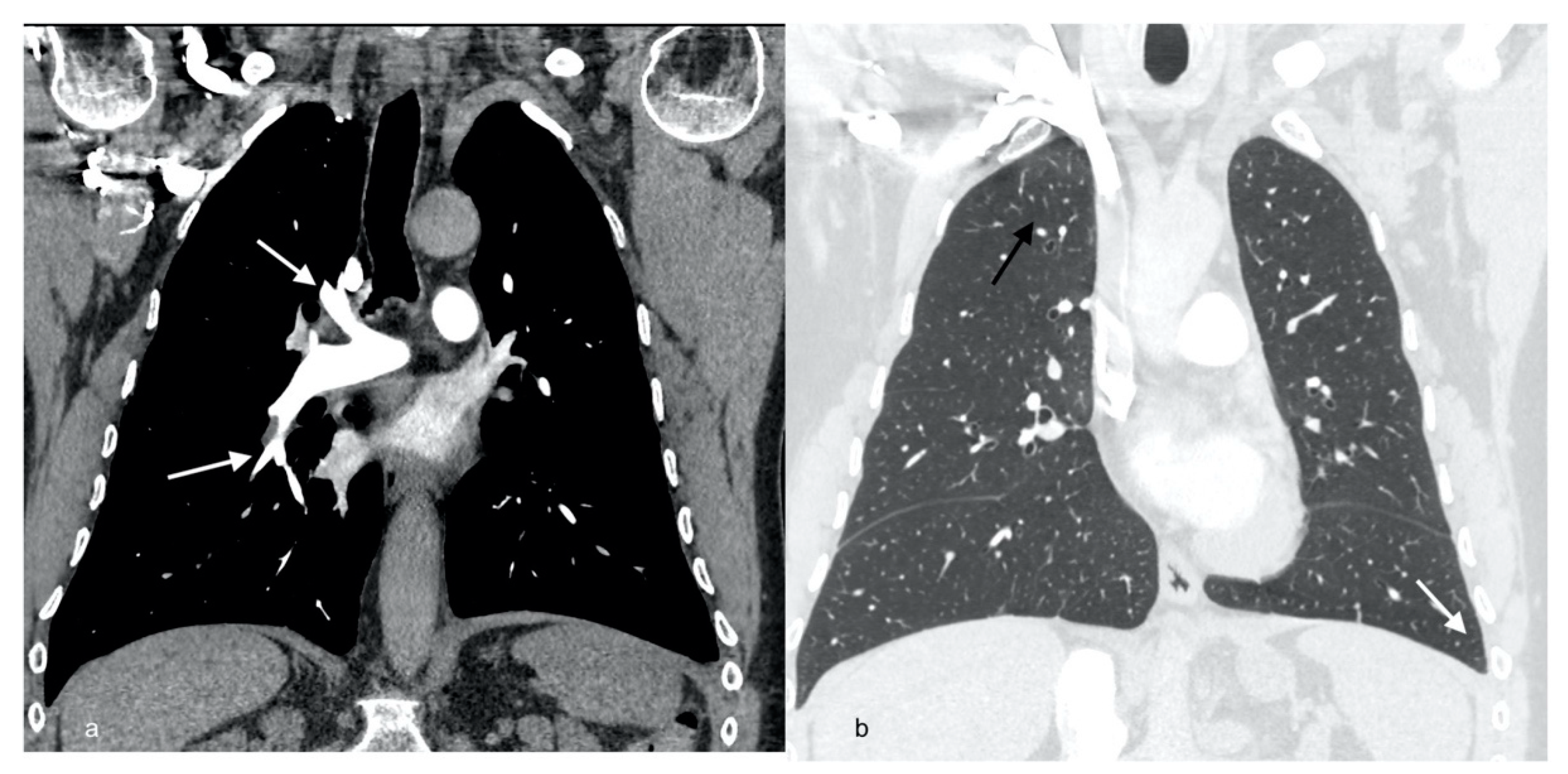 Diagnostics 12 01425 g004