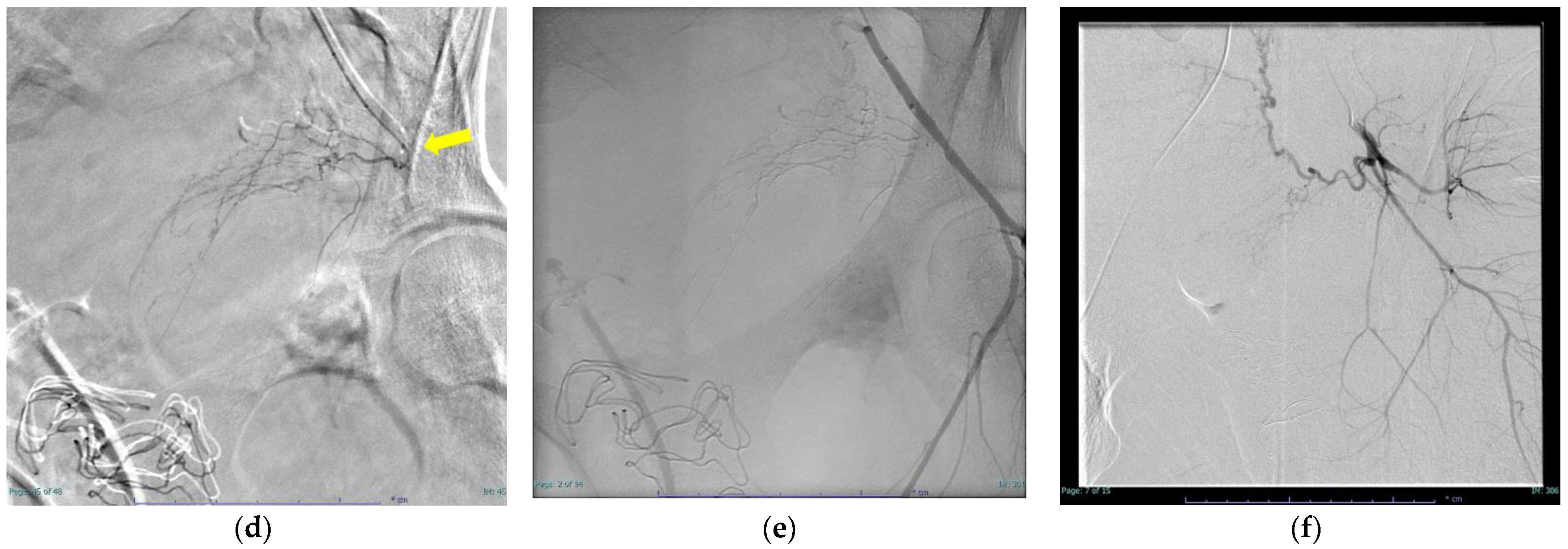 Diagnostics 12 01429 g003b