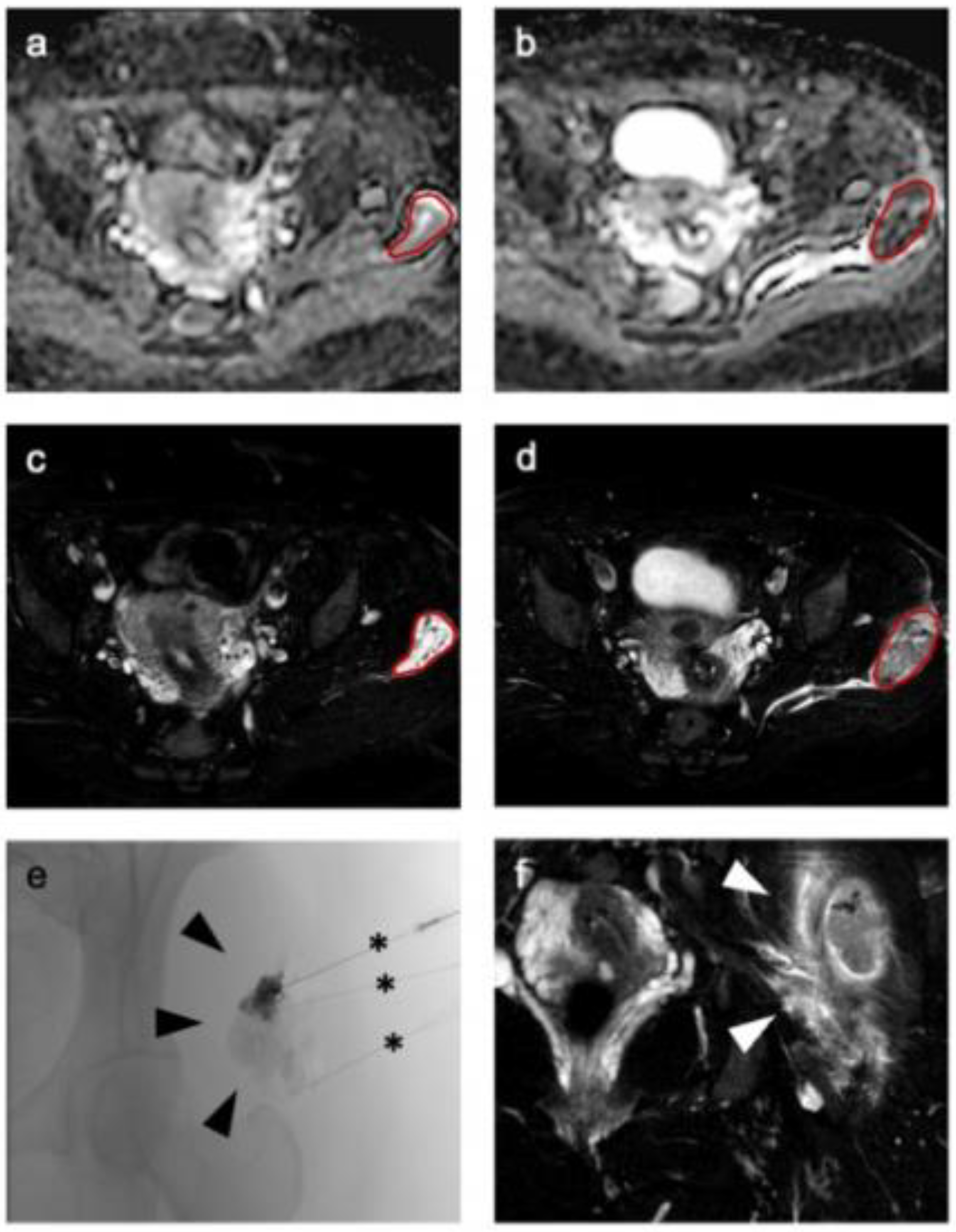 Diagnostics 12 01430 g002