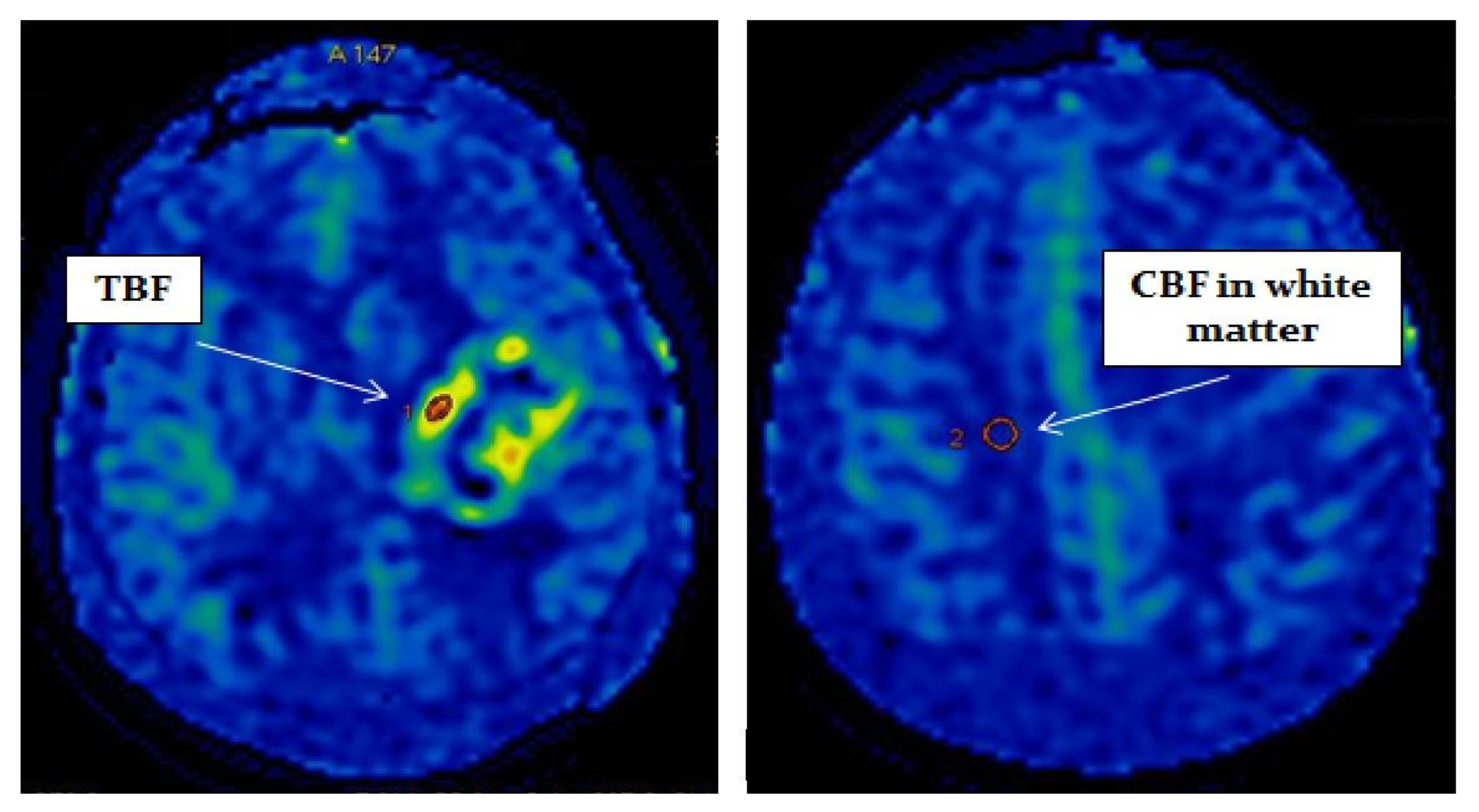 Diagnostics 12 01444 g001 550